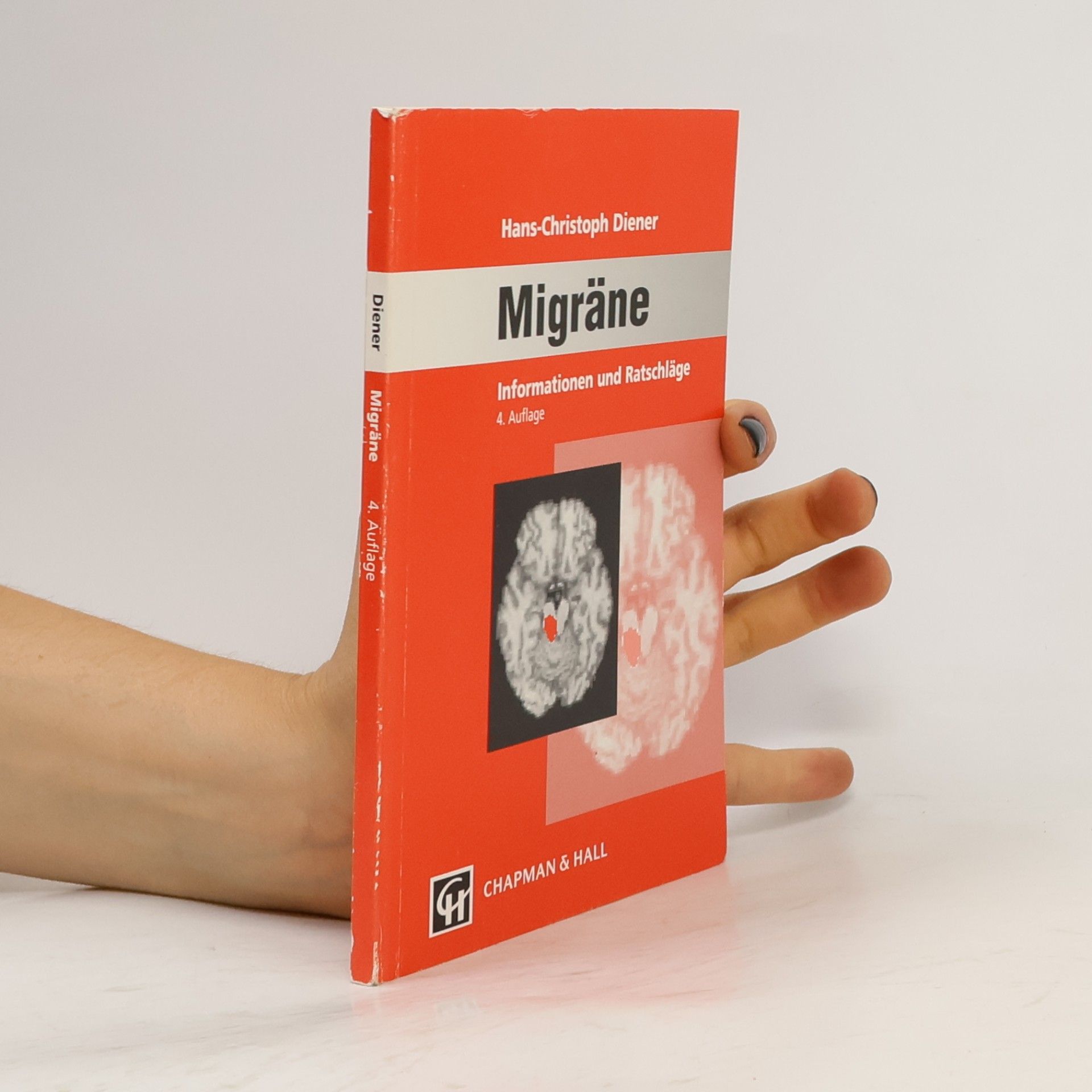 Migräne
