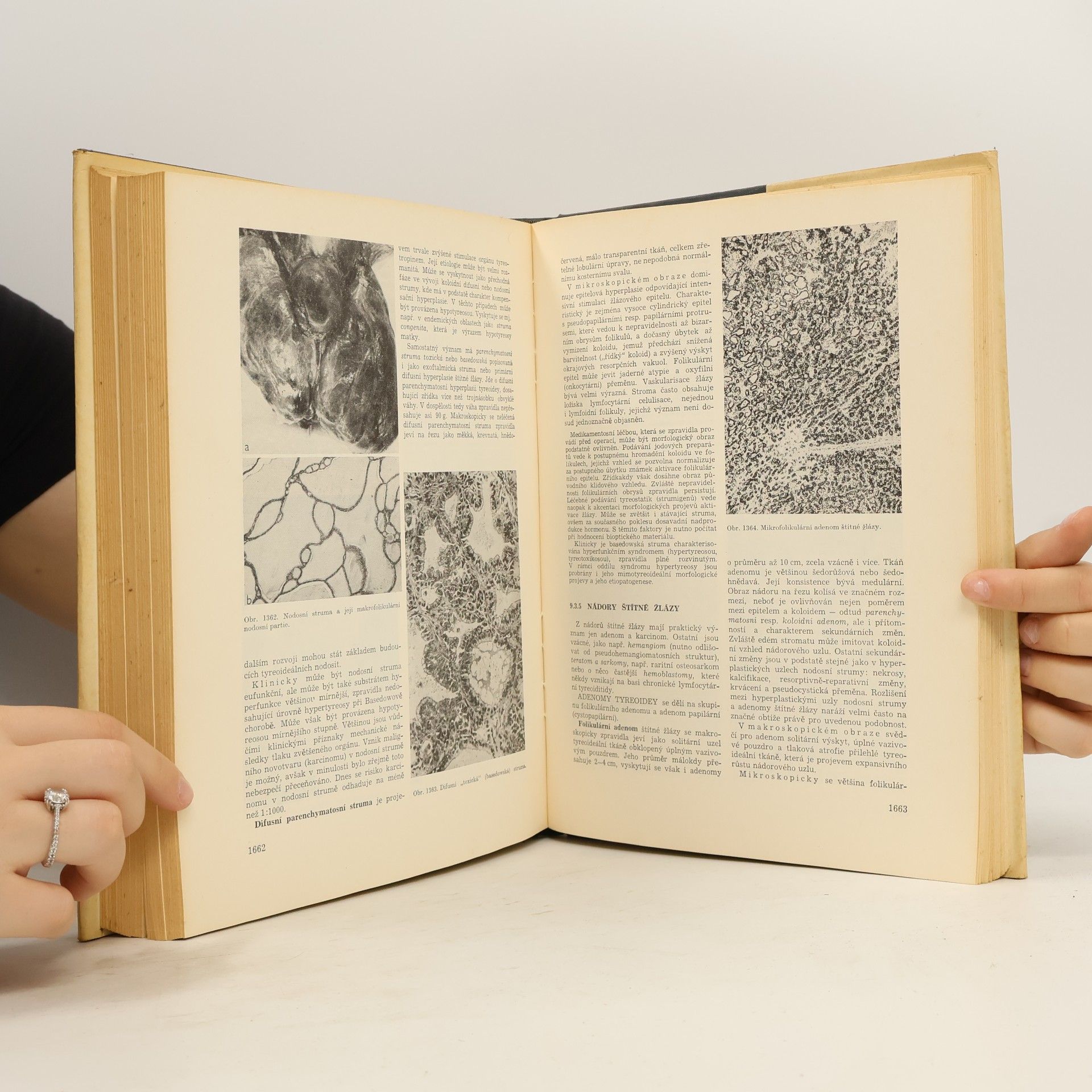 Blahoslav Bednář Patologie III.