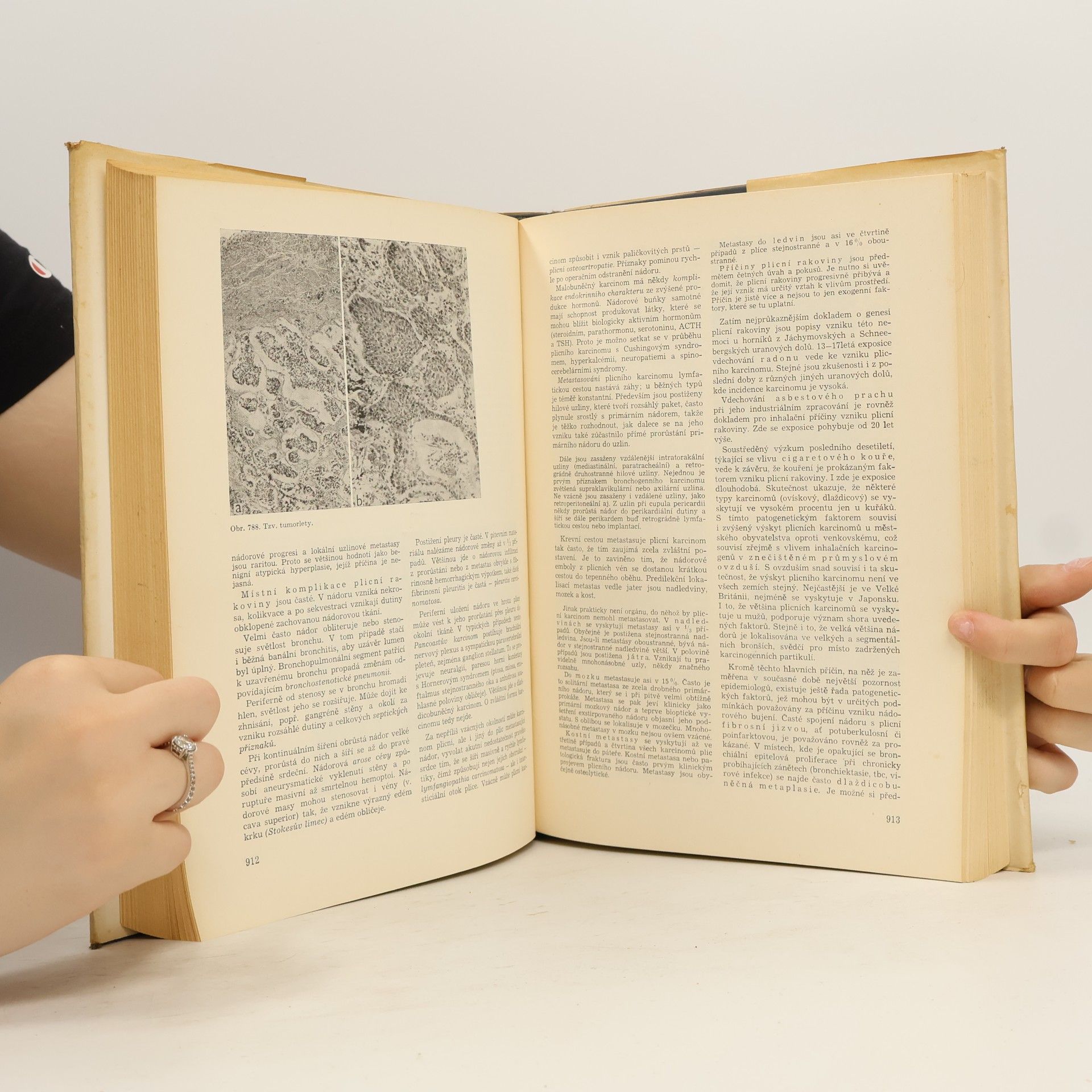 Blahoslav Bednář Patologie II