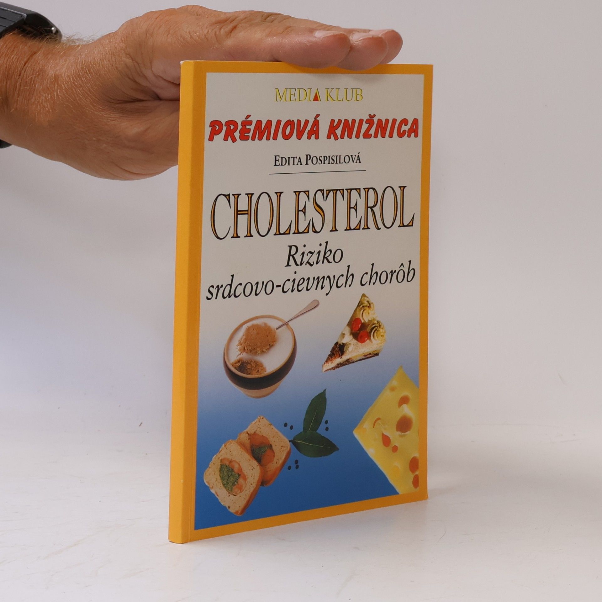 Cholesterol