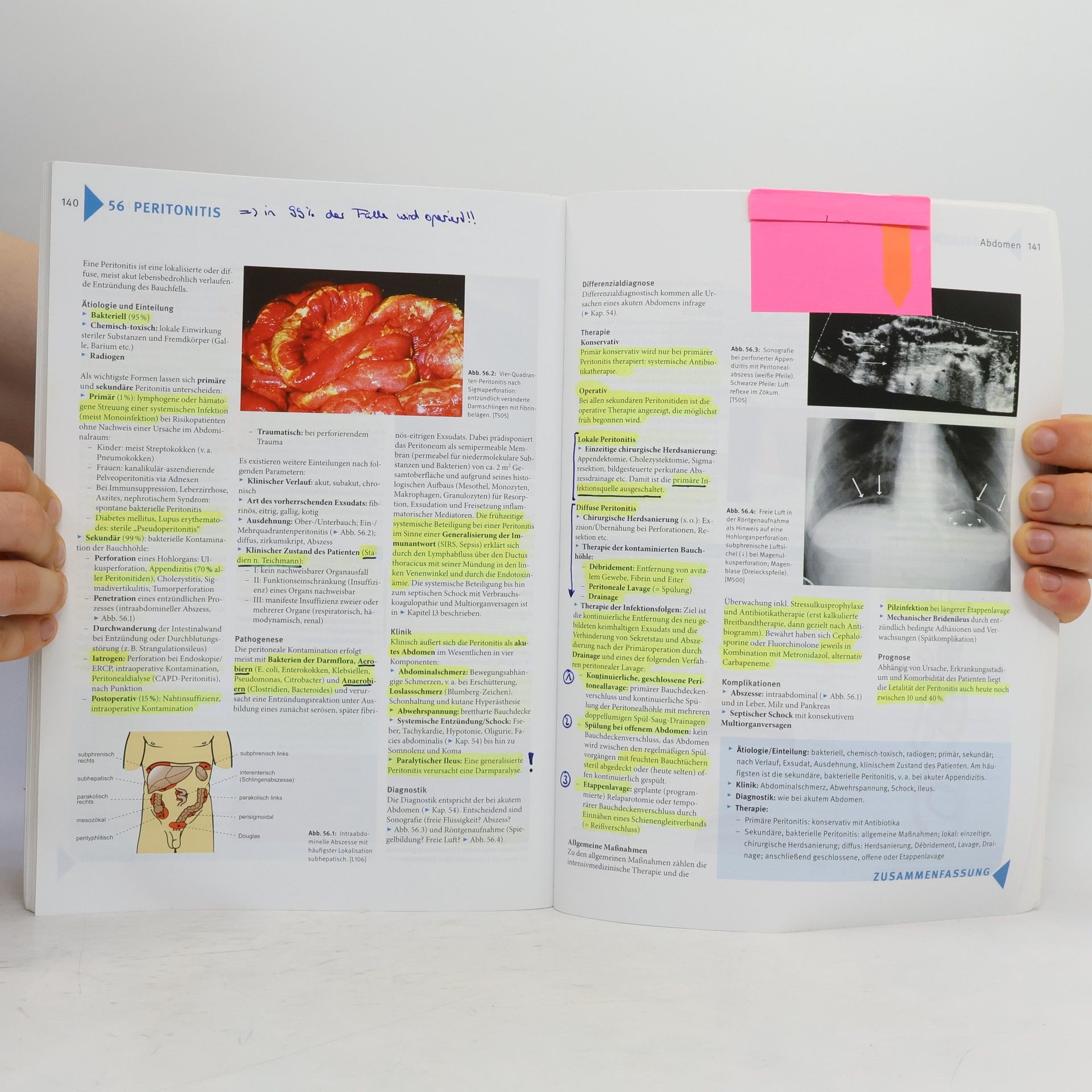 Tobias Schiergens Basics Chirurgie - 3. Auflage