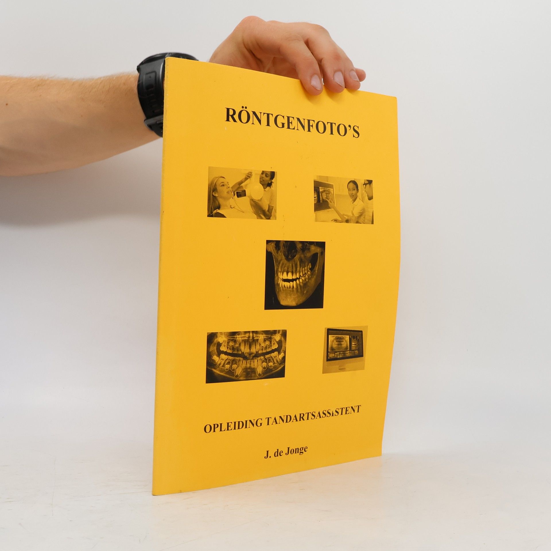 J. de Jonge Röntgenfoto's