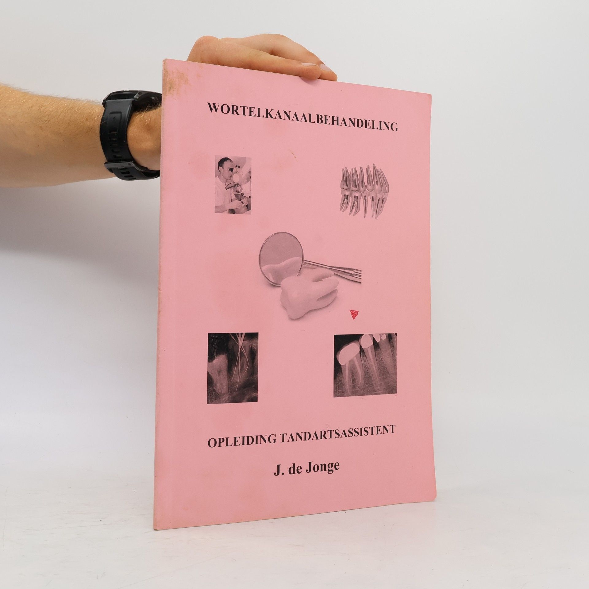 Wortelkanaalbehandeling