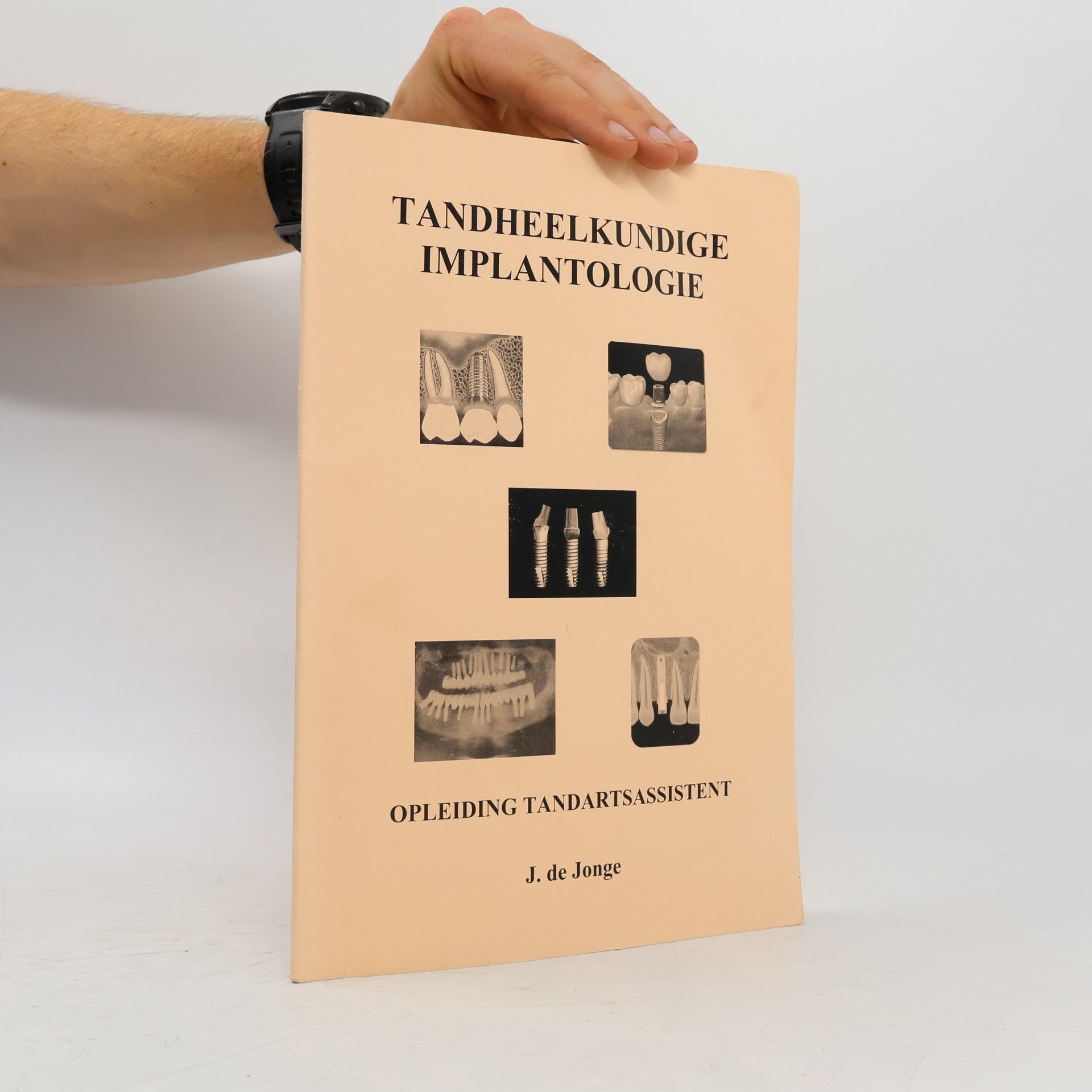 Tandheelkundige Implantologie
