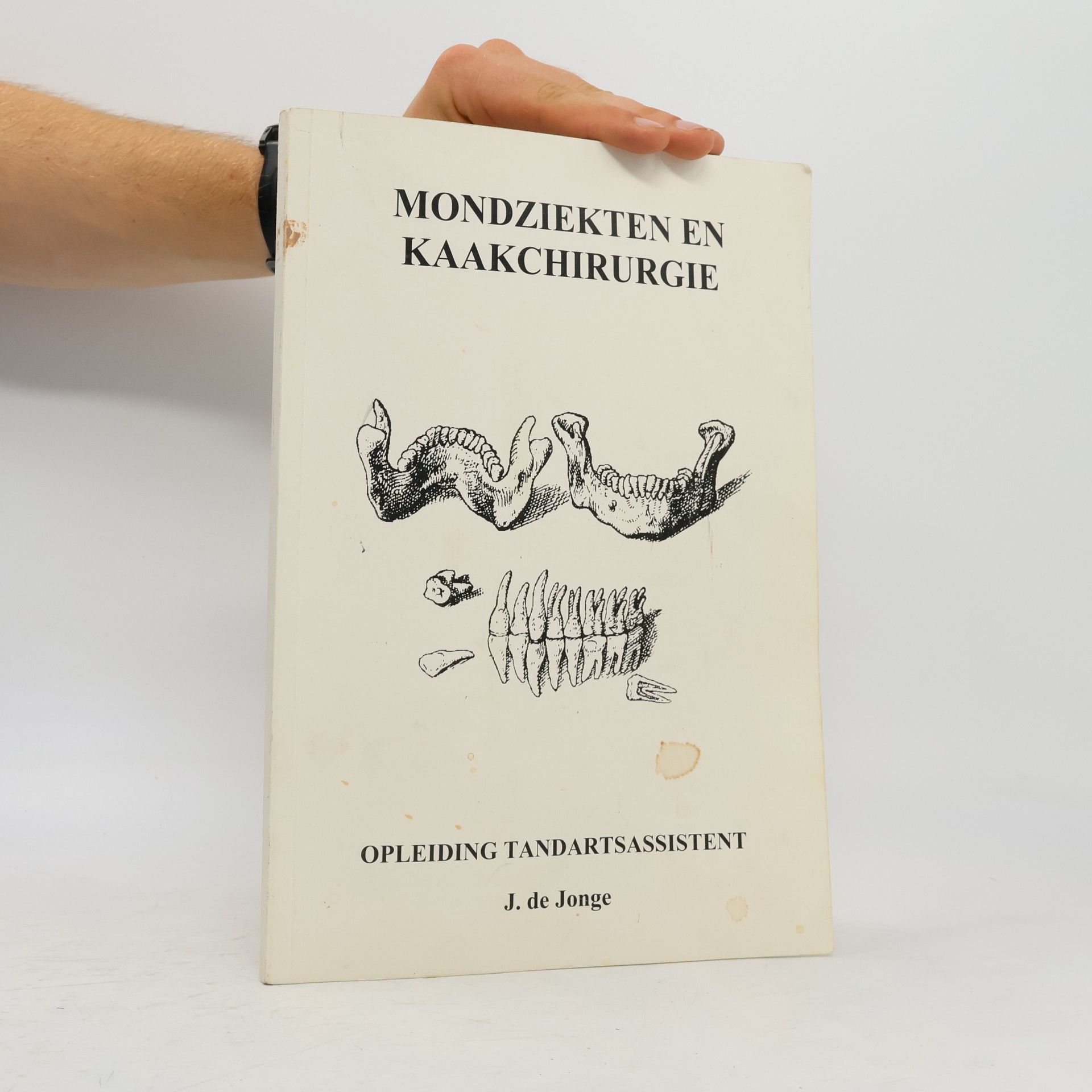 Mondziekten en kaakchirurgie