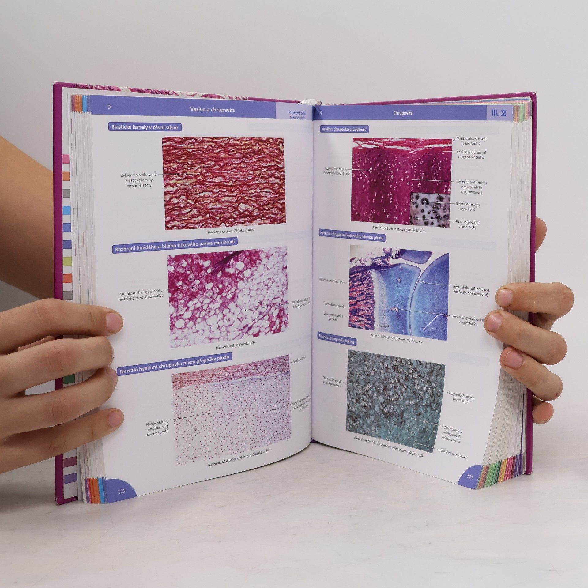 Ivan Varga Memorix histologie