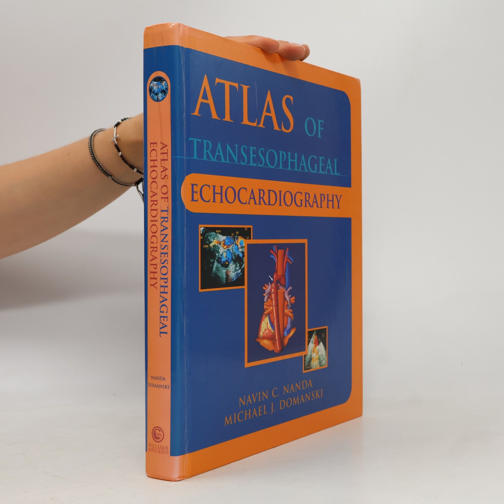 Michael Domanski Atlas of Transesophageal Echocardiography