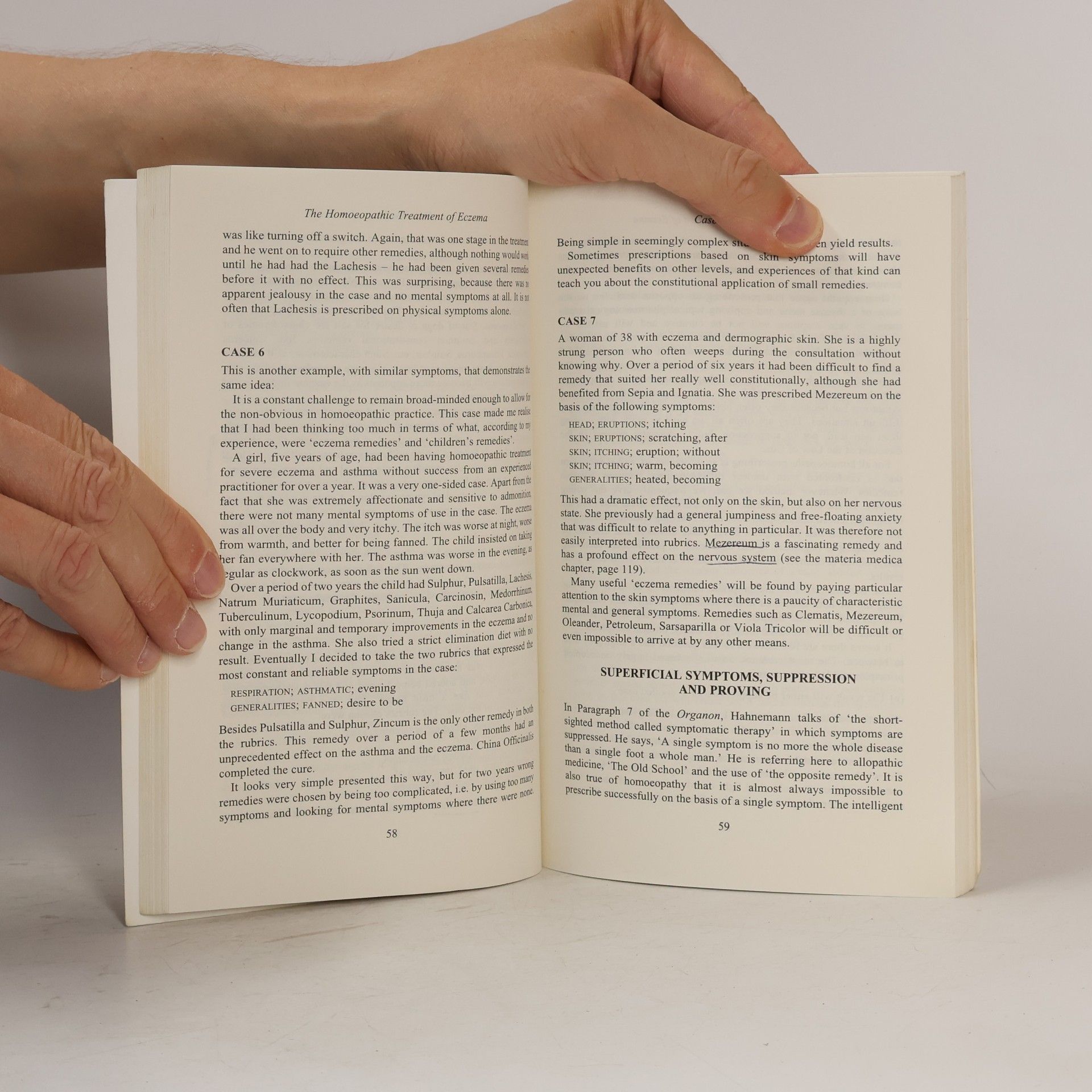 Robin Logan The Homoeopathic Treatment of Eczema