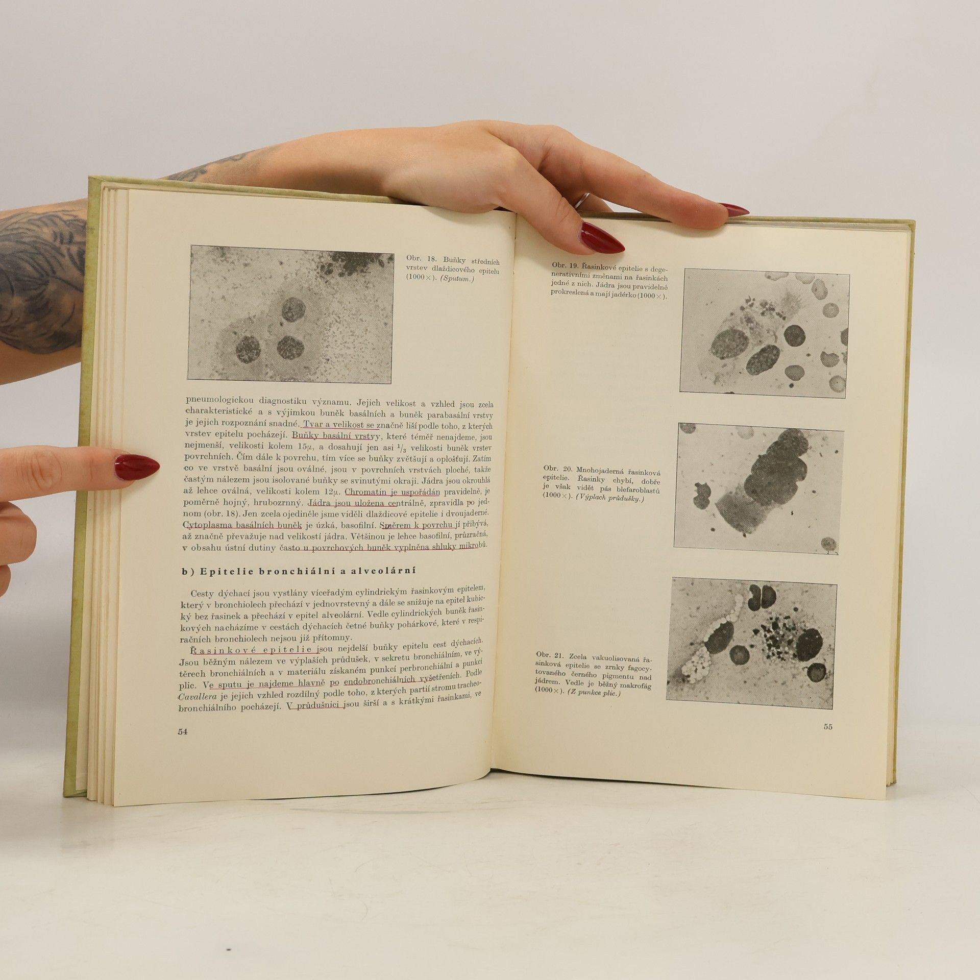 Cyril Šimeček Cytologická vyšetření v pneumologii