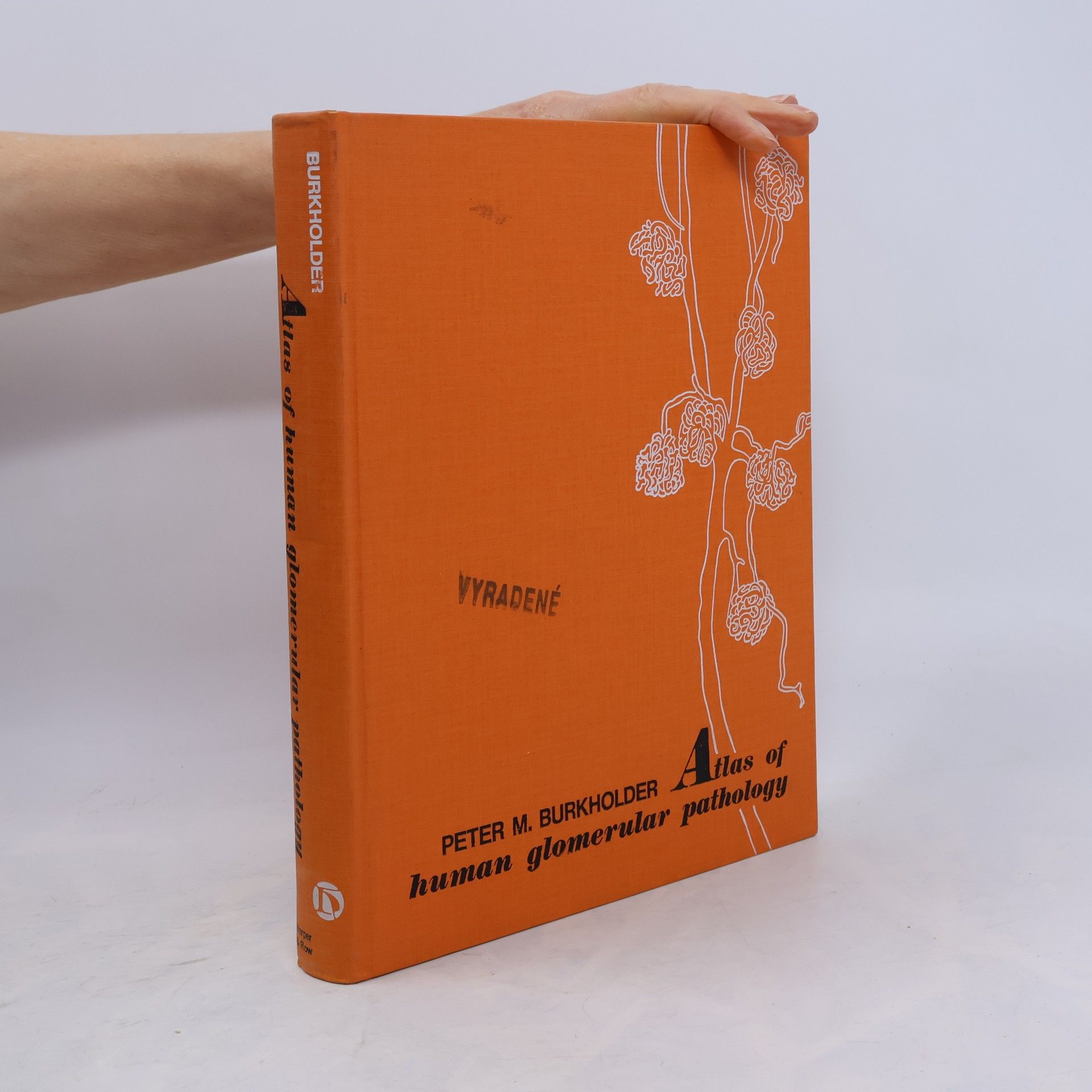 Peter M. Burkholder Atlas of Human Glomerular Pathology