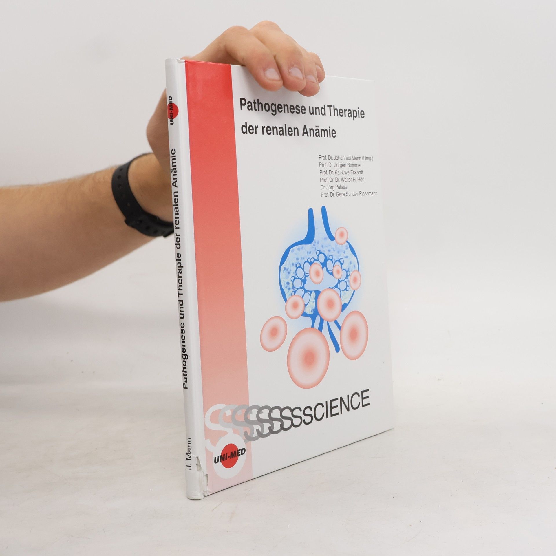 Pathogenese und Therapie der renalen Anämie