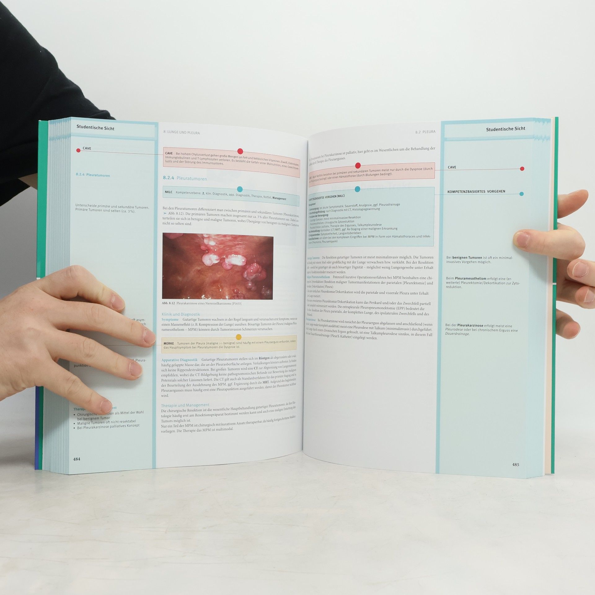 U. Obertacke Chirurgie hoch2 + E-Book