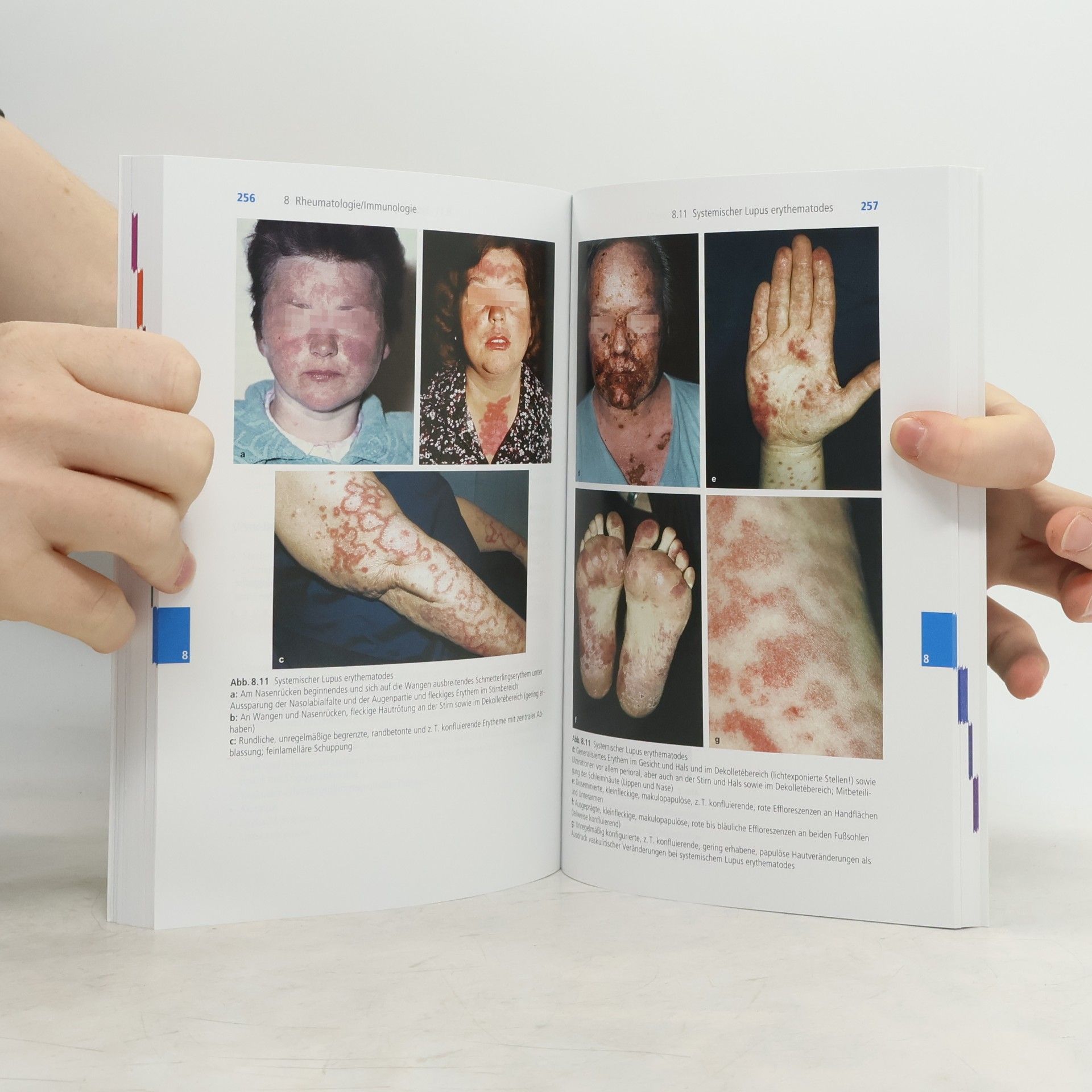 Gunter Gruber Blickdiagnosen Innere Medizin