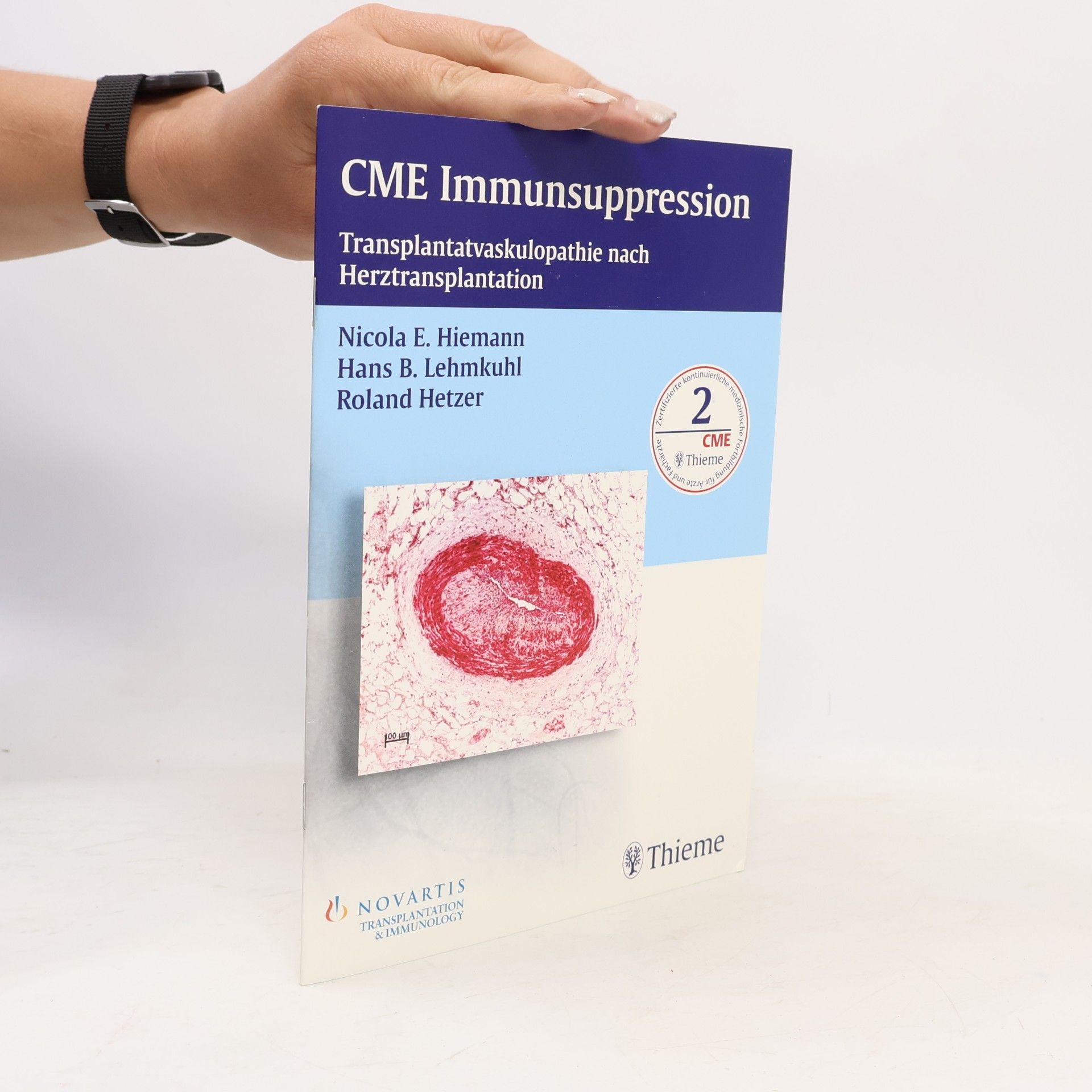 Autorenkollektiv CME Immunsuppression: Transplantatvaskulopathie nach Herztransplantation