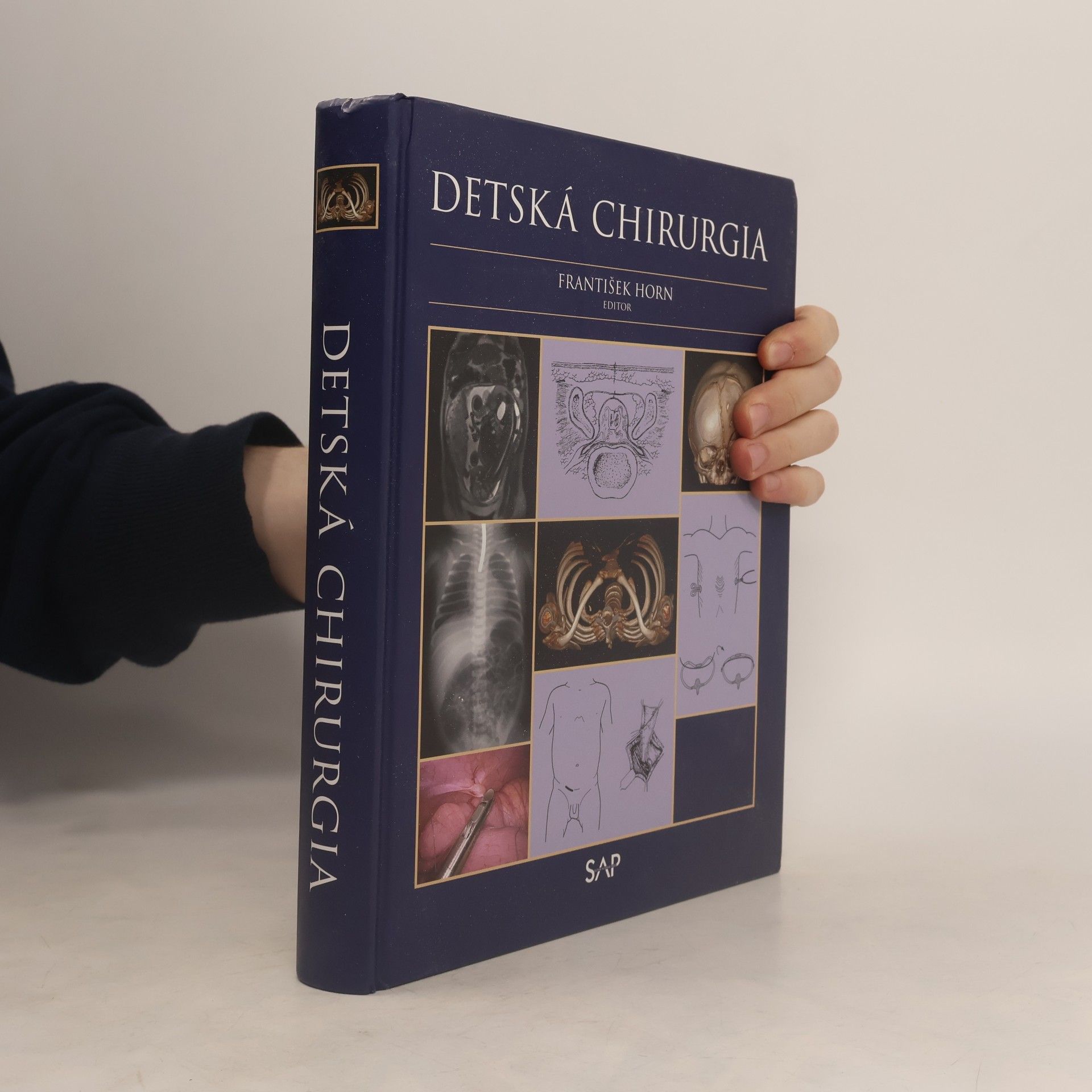 Detská chirurgia