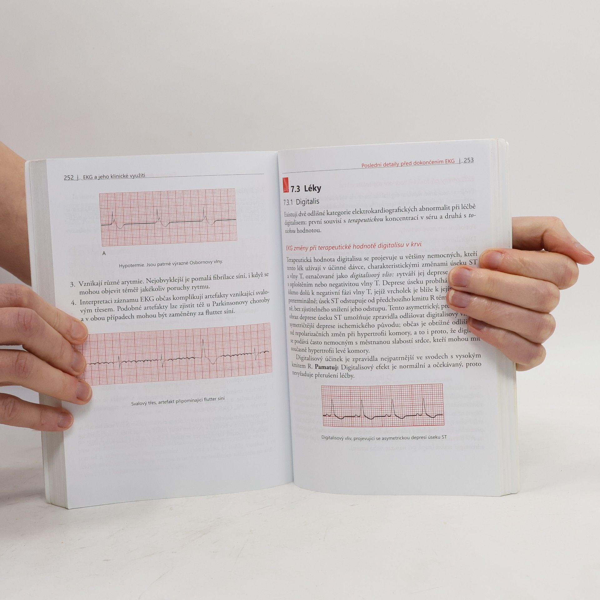 Malcolm S. Thaler EKG a jeho klinické využití