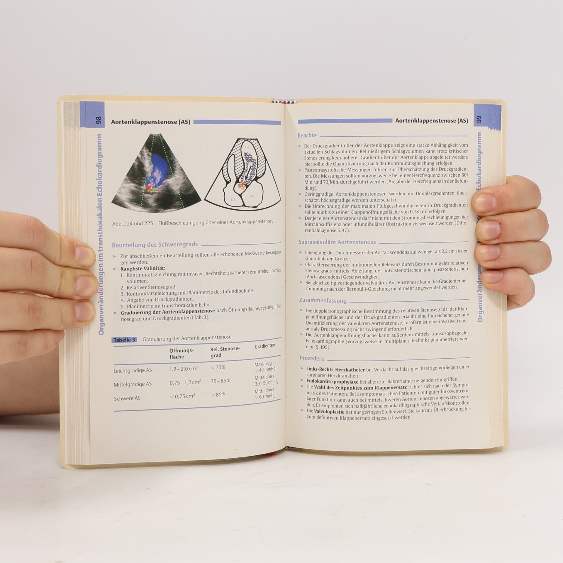 Thomas Böhmeke Checkliste Echokardiographie