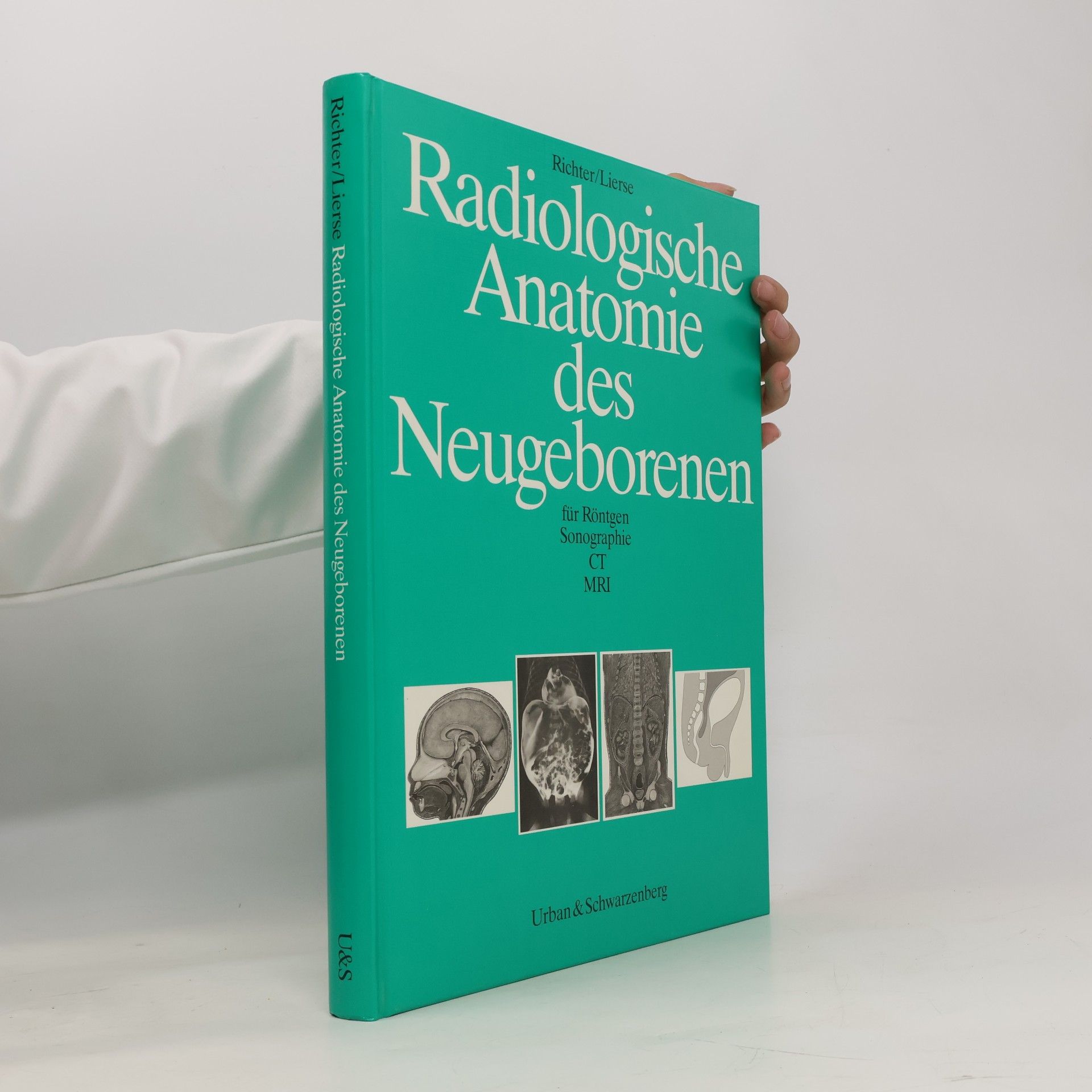 Werner Lierse Radiologische Anatomie des Neugeborenen