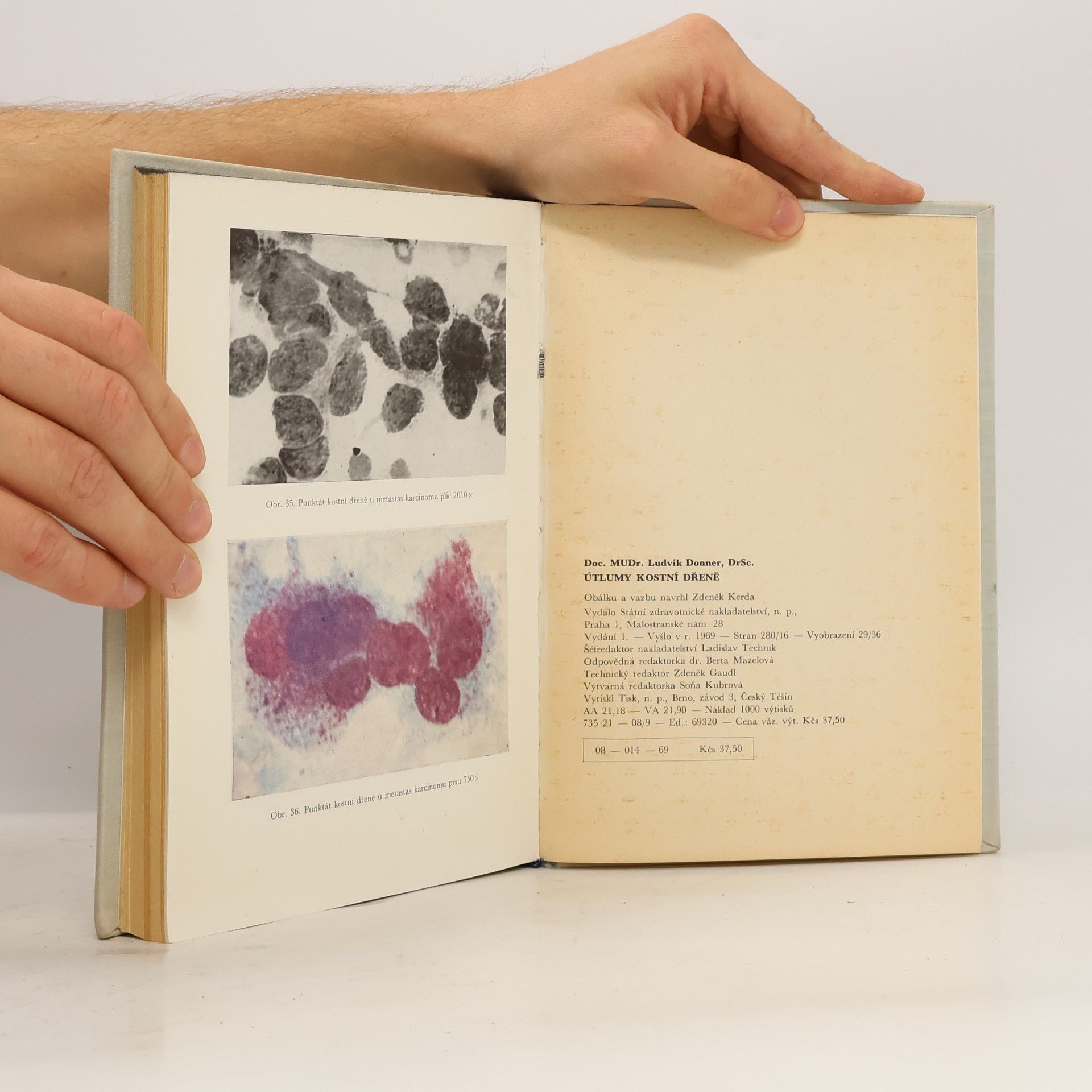 Ludvík Donner Útlumy kostní dřeně