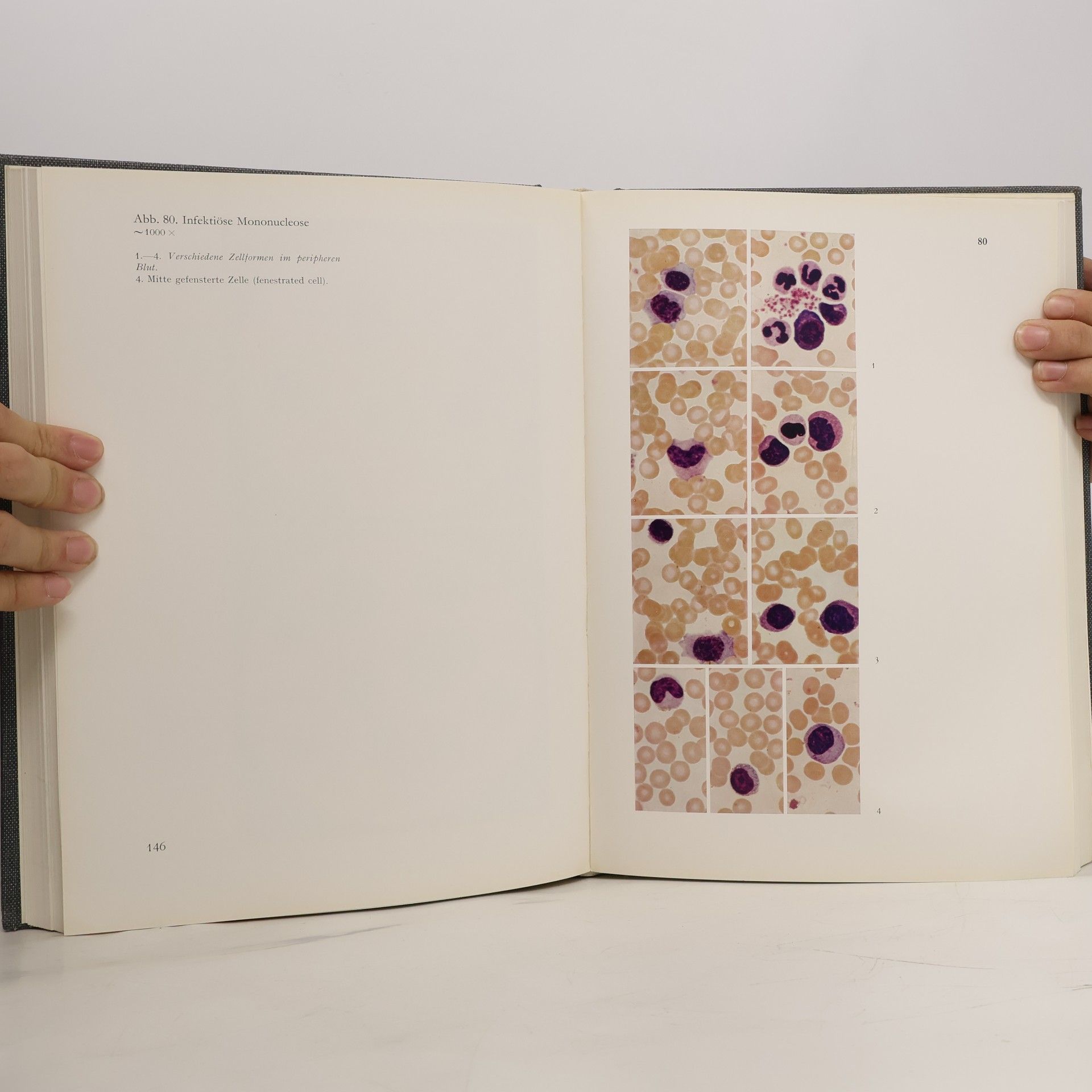 Herbert Begemann Atlas der klinischen Hämatologie