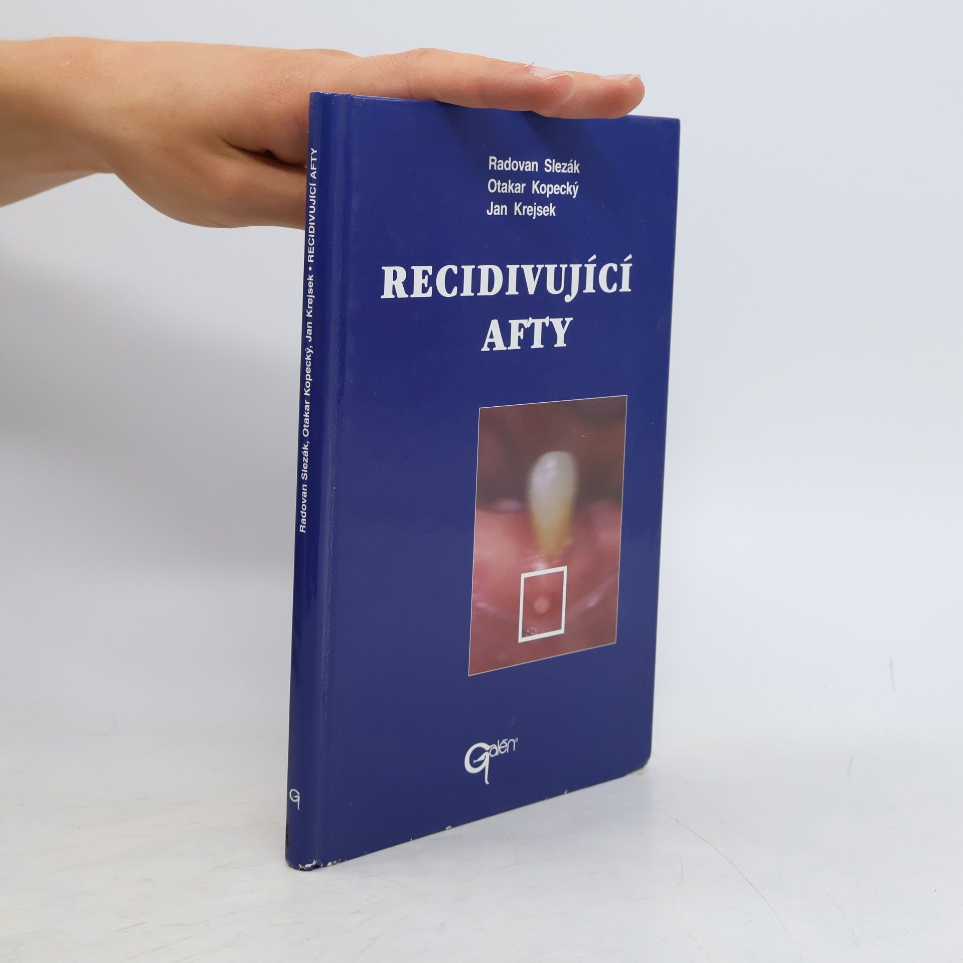 Recidivující afty