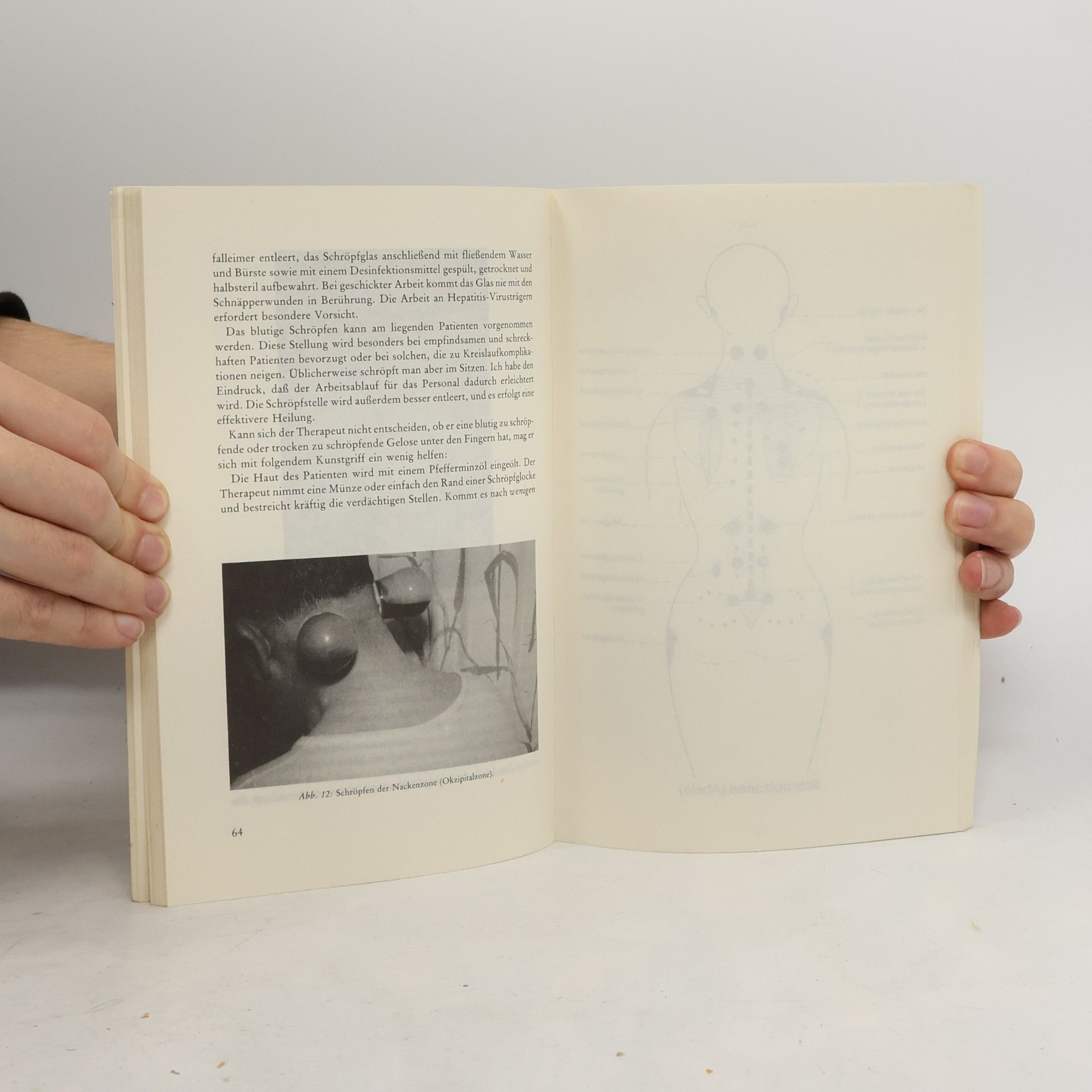 Johann Abele Lehrbuch der Schröpfkopfbehandlung