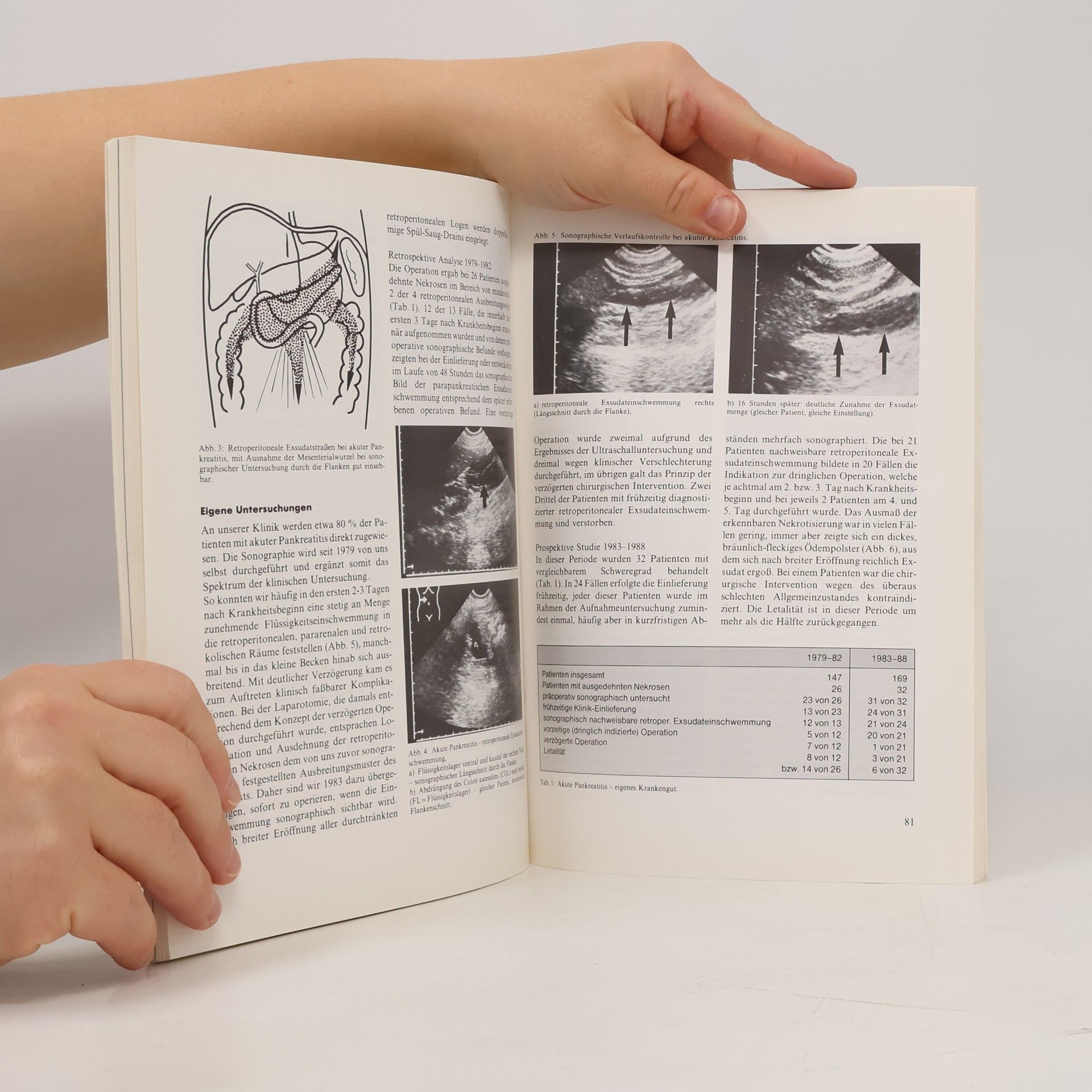 Various authors Akute Pankreatitis