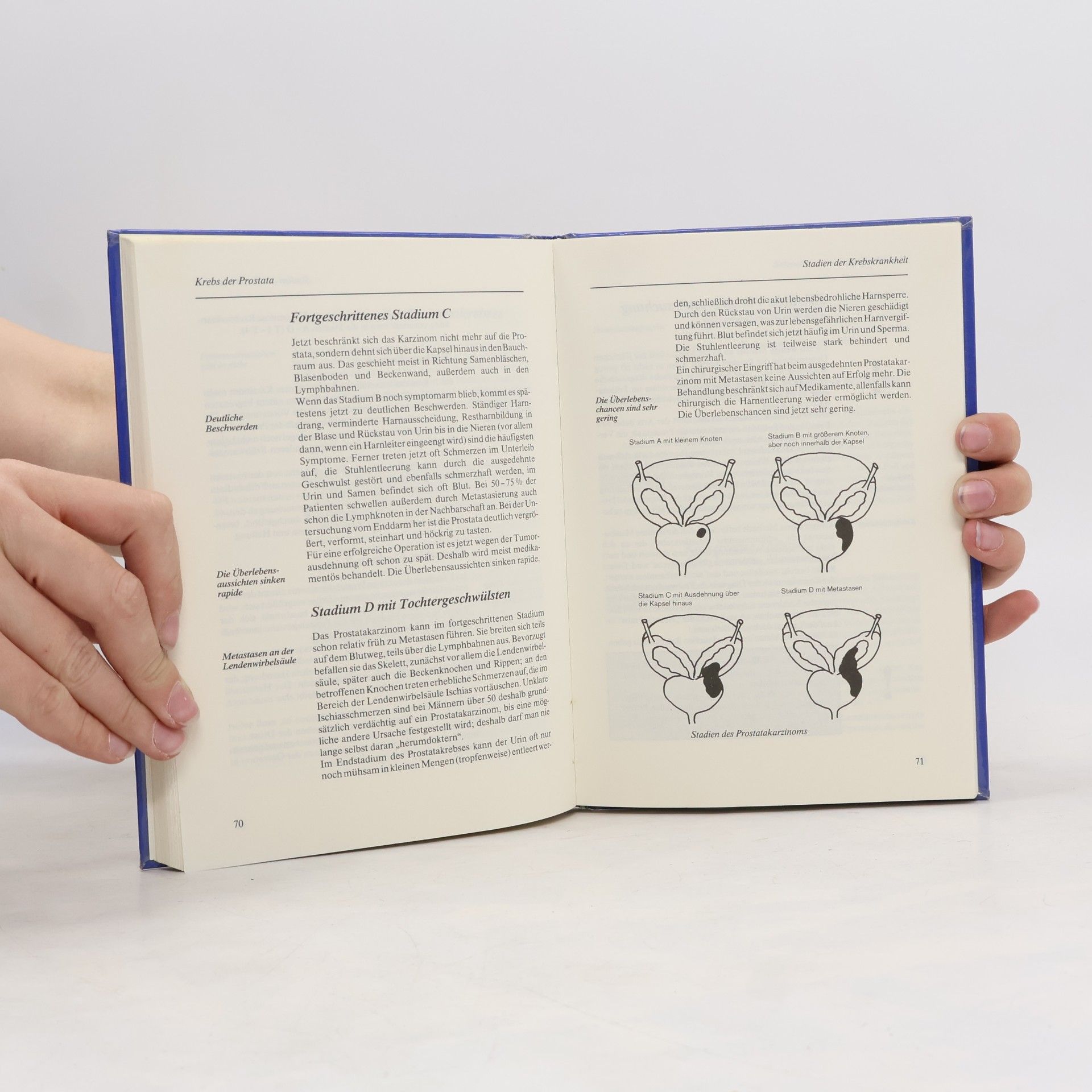 Gerhard Leibold Erkrankungen der Prostata: das Leiden des Mannes
