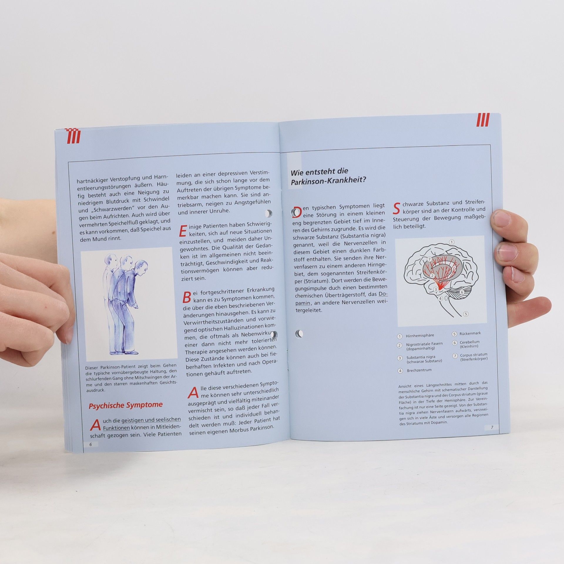 Collectif d'auteurs Die Parkinsonsche-Krankheit und Ihre medikamentöse Behandlung