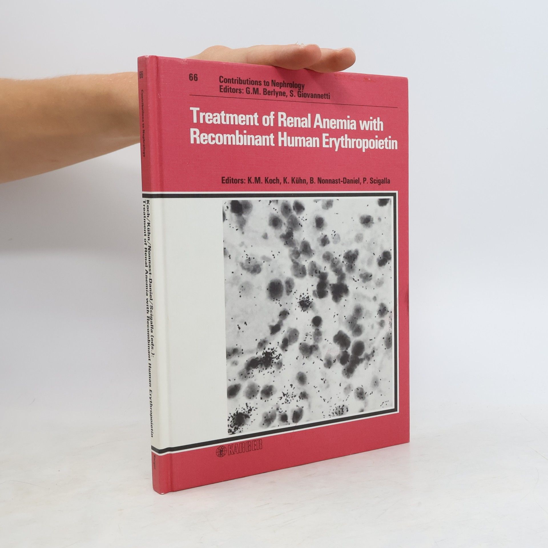 Karl Martin Koch Treatment of renal anemia with recombinant human erythropoietin