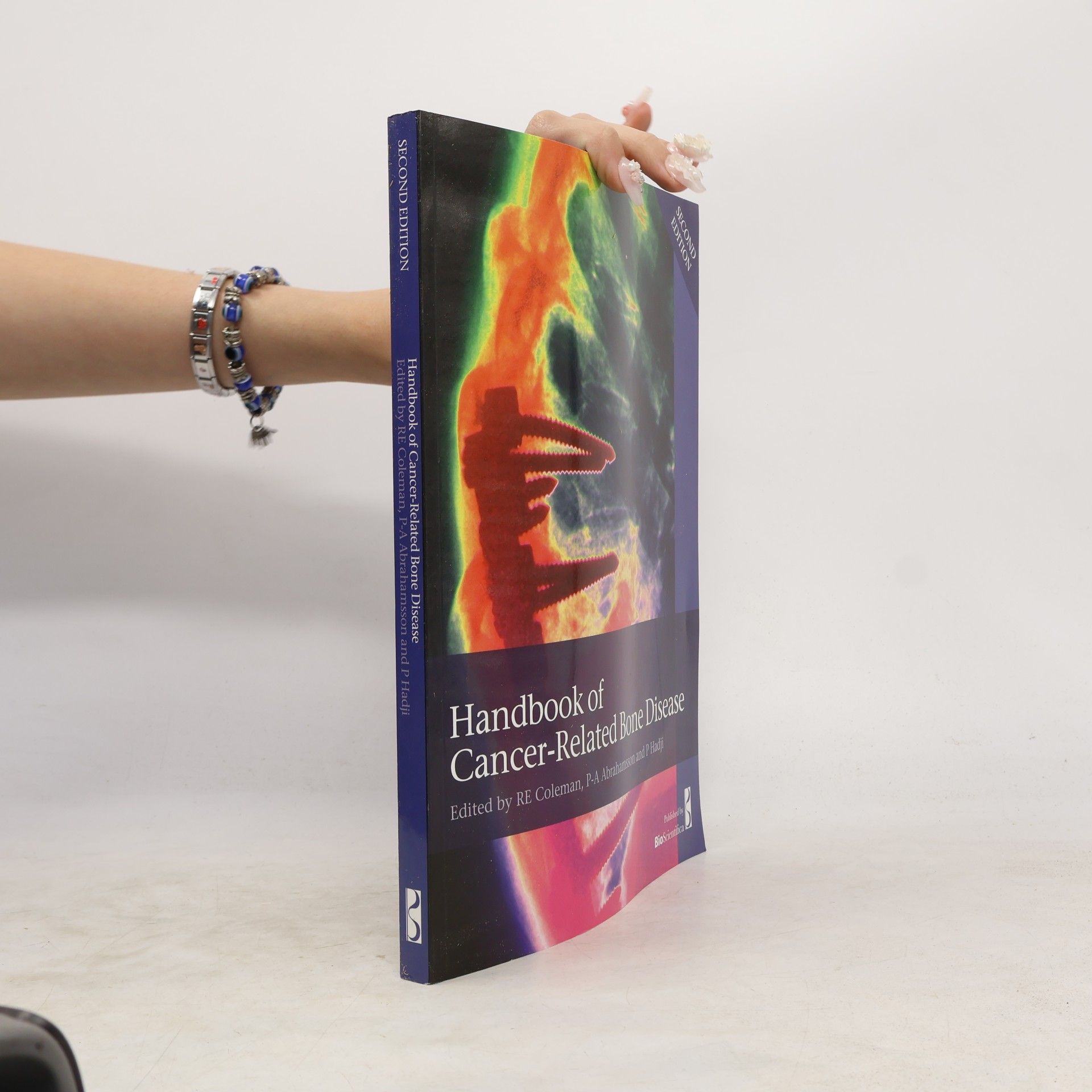Handbook of Cancer-Related Bone Disease Second Edition