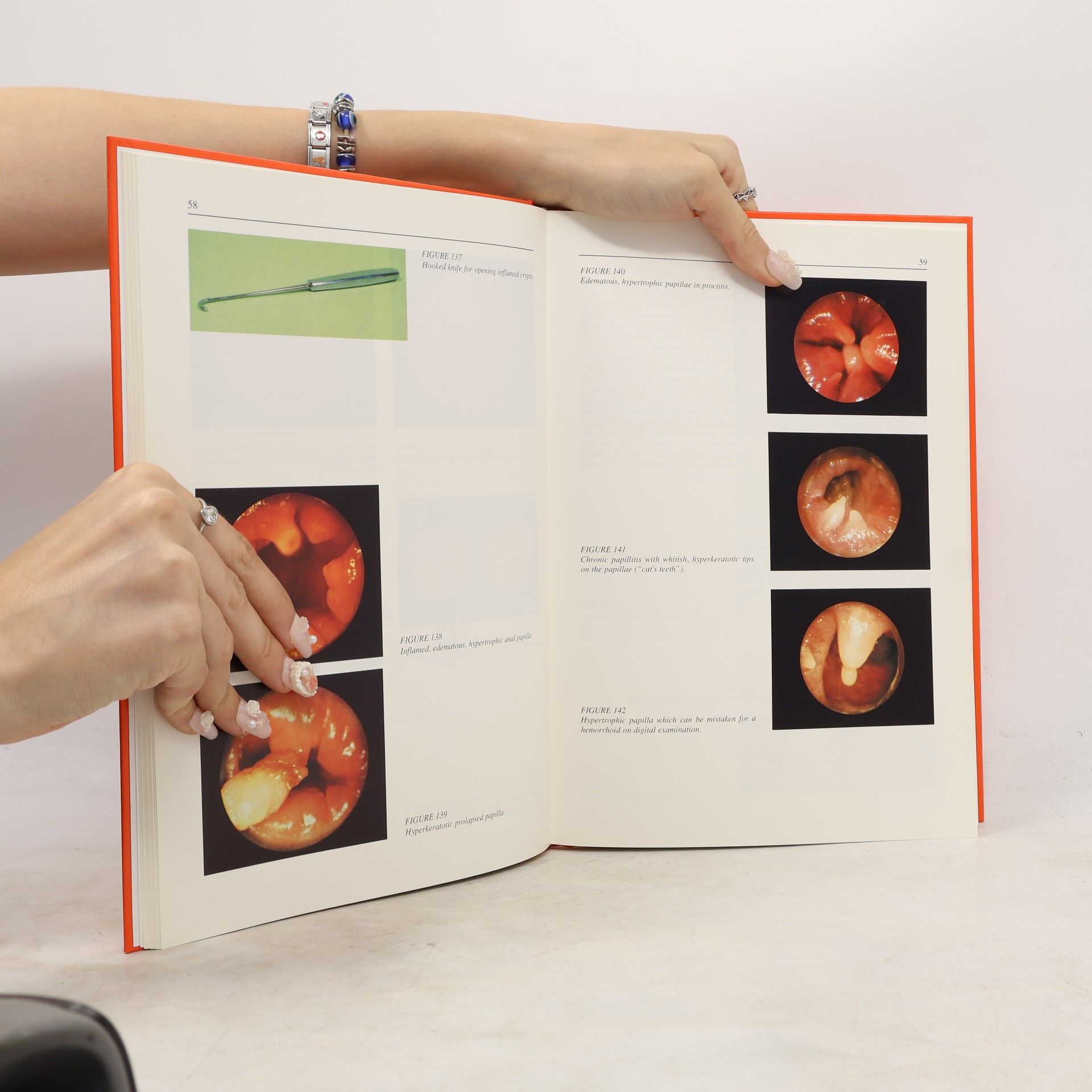 Alexander Neiger Atlas of Practical Proctology