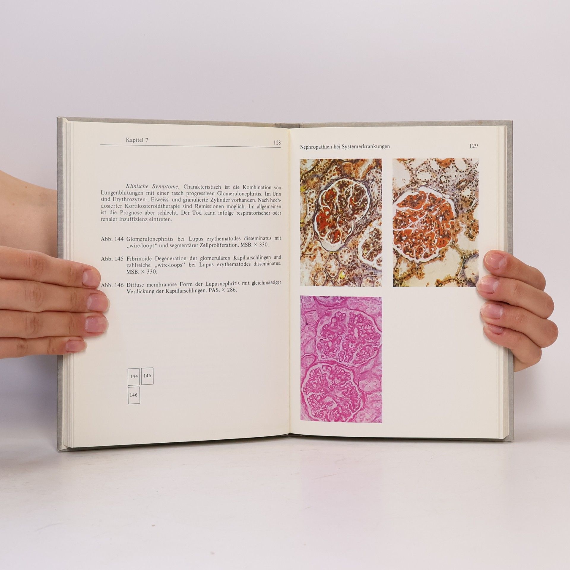 George Williams Atlas der Nierenerkrankungen