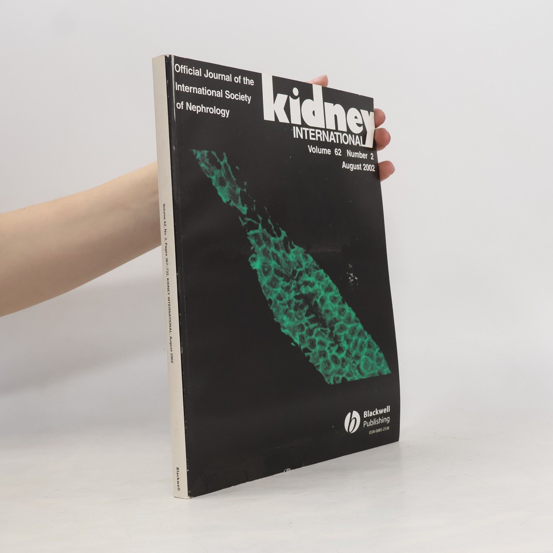 Autorenkollektiv Kidney International. Volume 62, Number 2