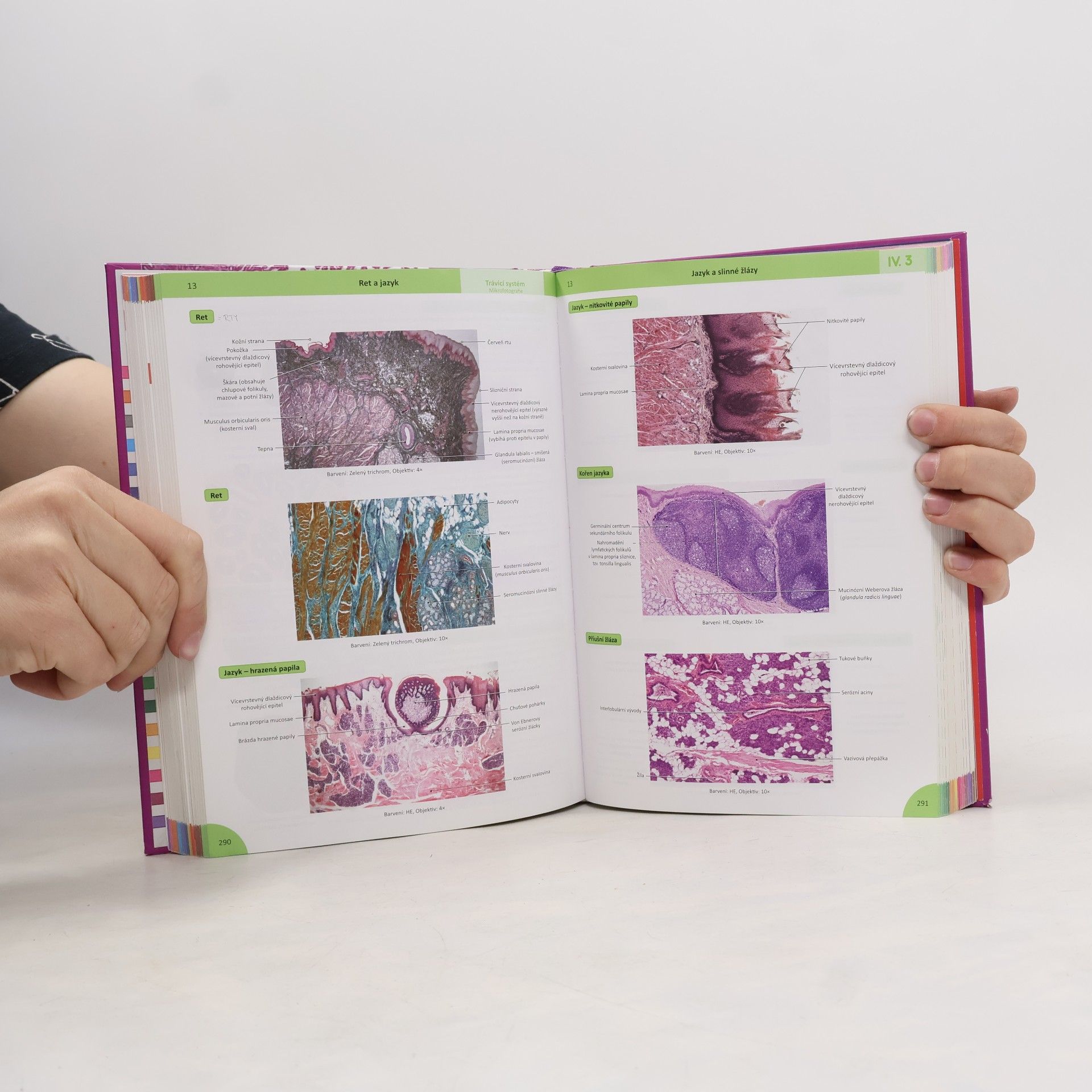 Ivan Varga Memorix histologie