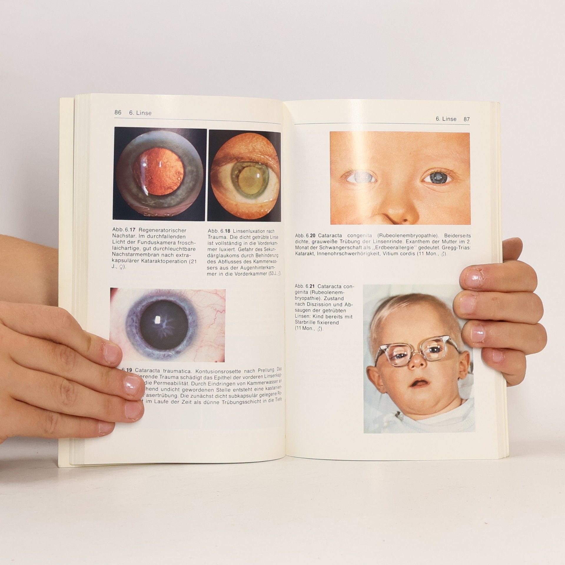 Fritz Hollwich Taschenatlas der Augenheilkunde - 3. überarbeitete Auflage