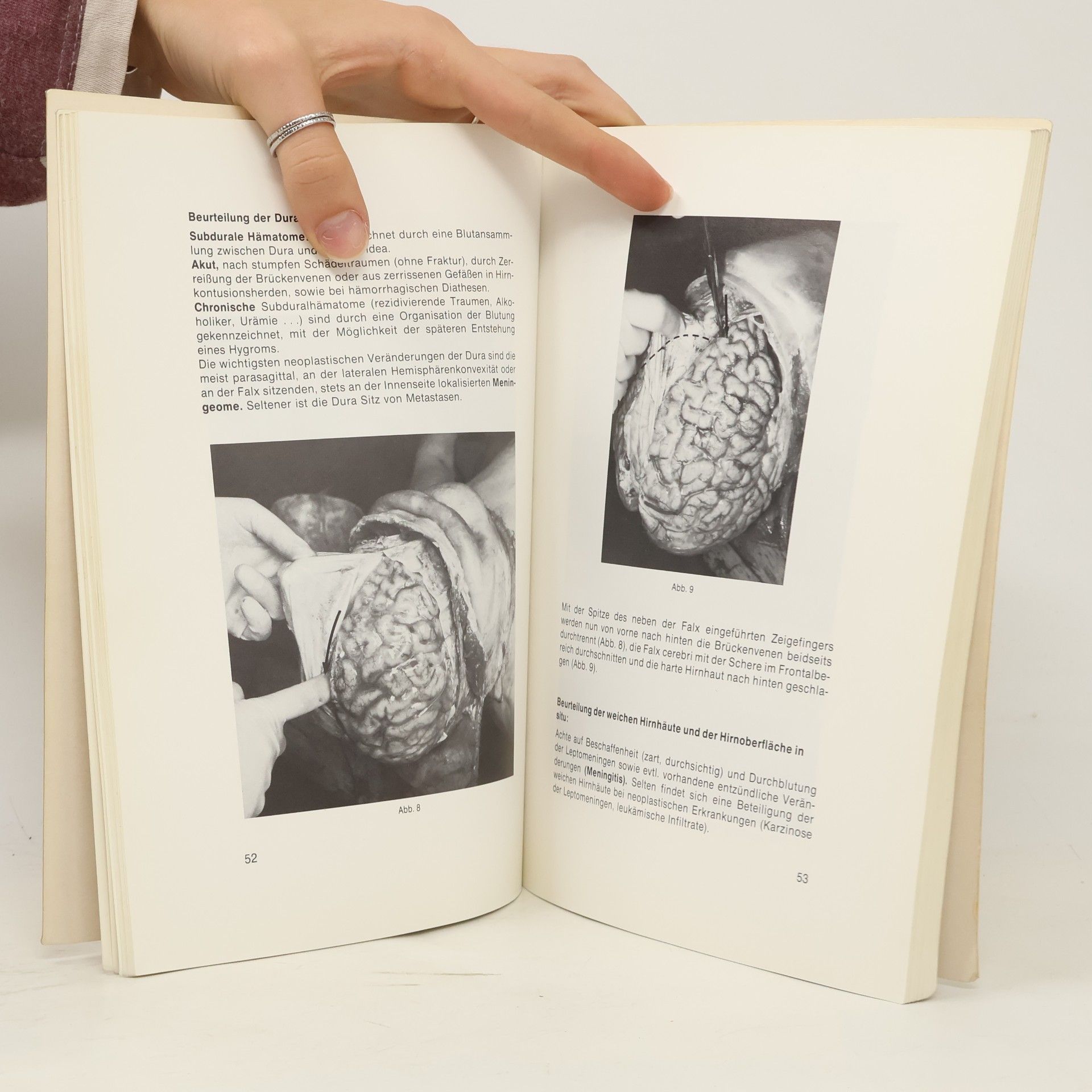 Johann Heinrich Holzner Pathologisch-anatomisches Praktikum