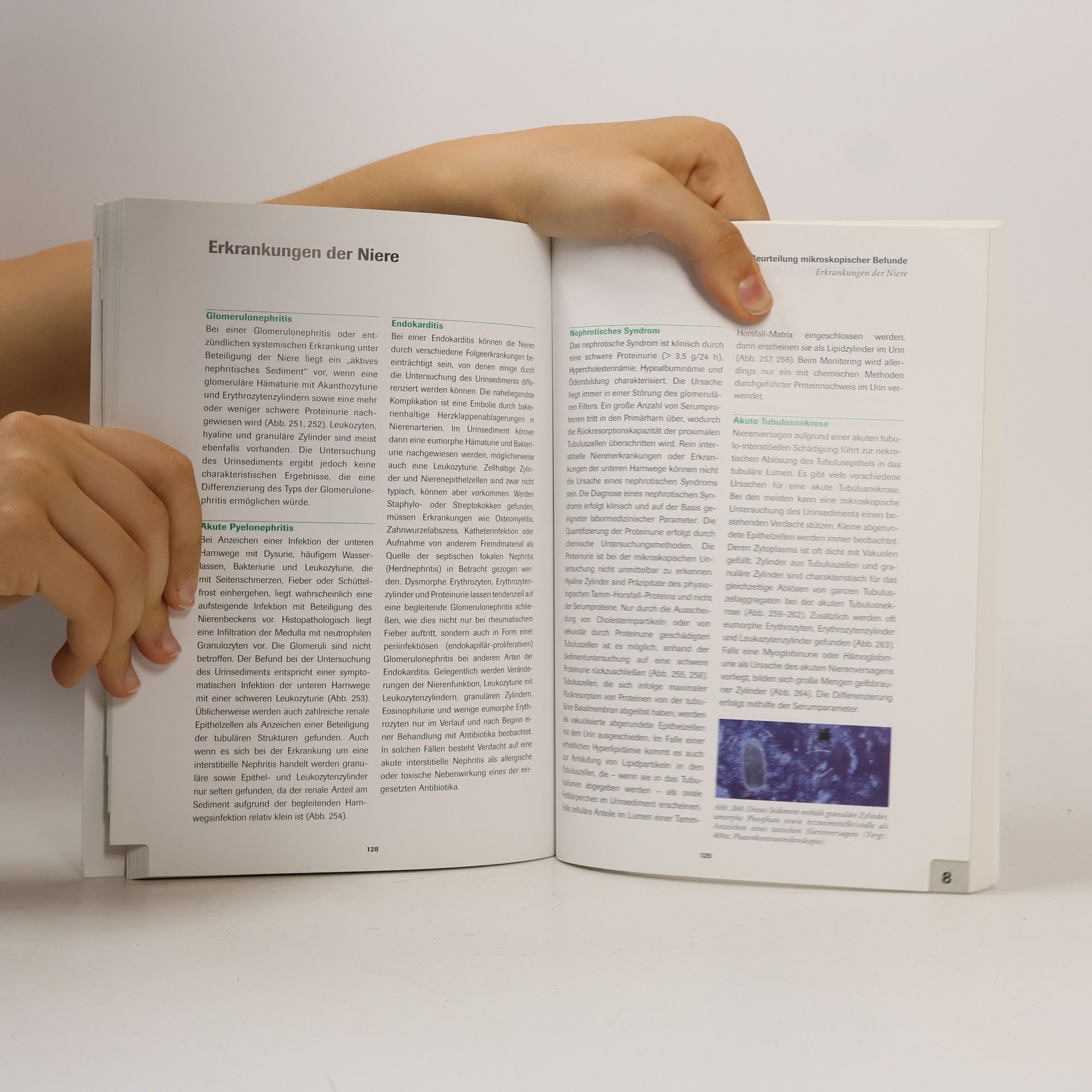 kolektiv Kompendium der Urinanalyse