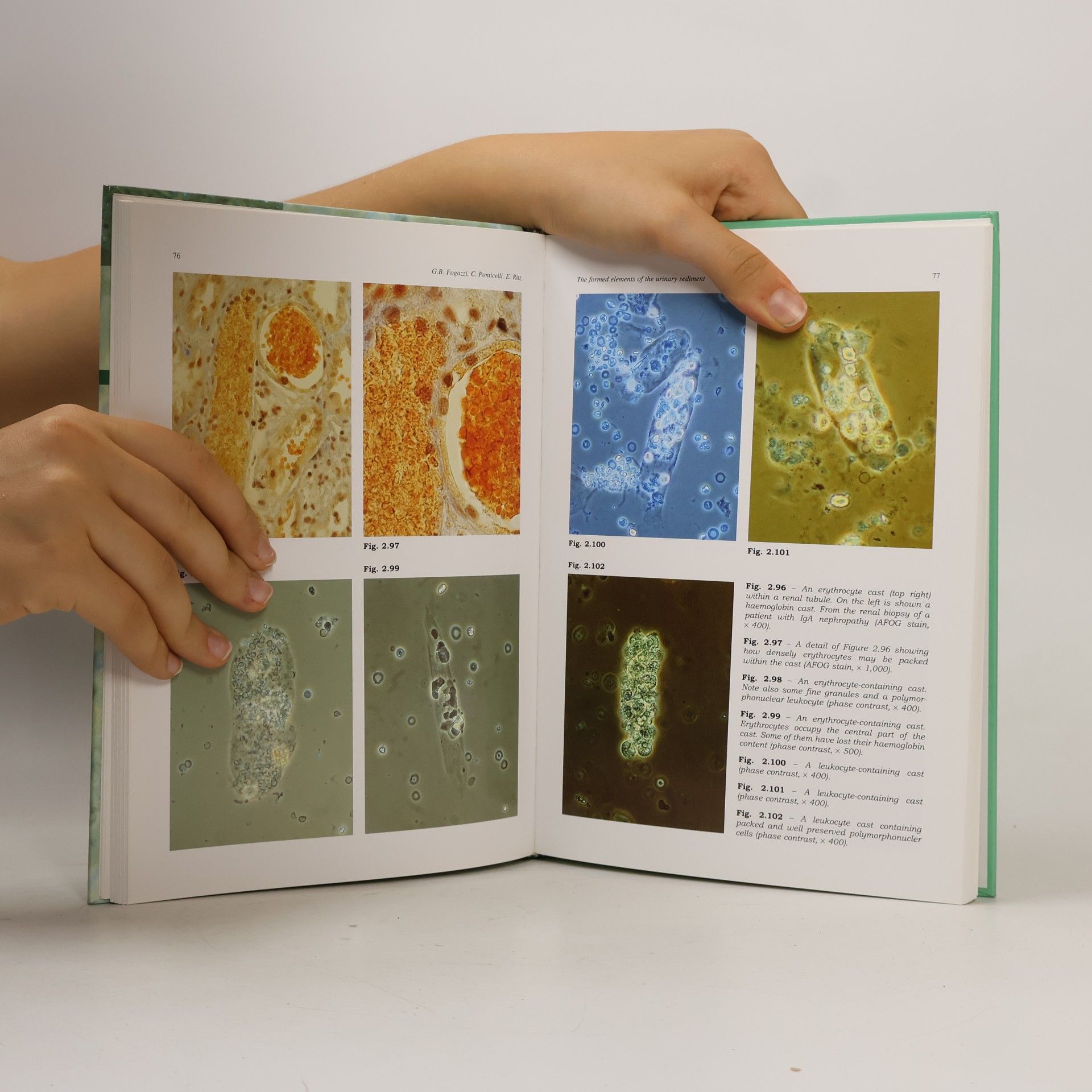 Eberhard Ritz The Urinary Sediment