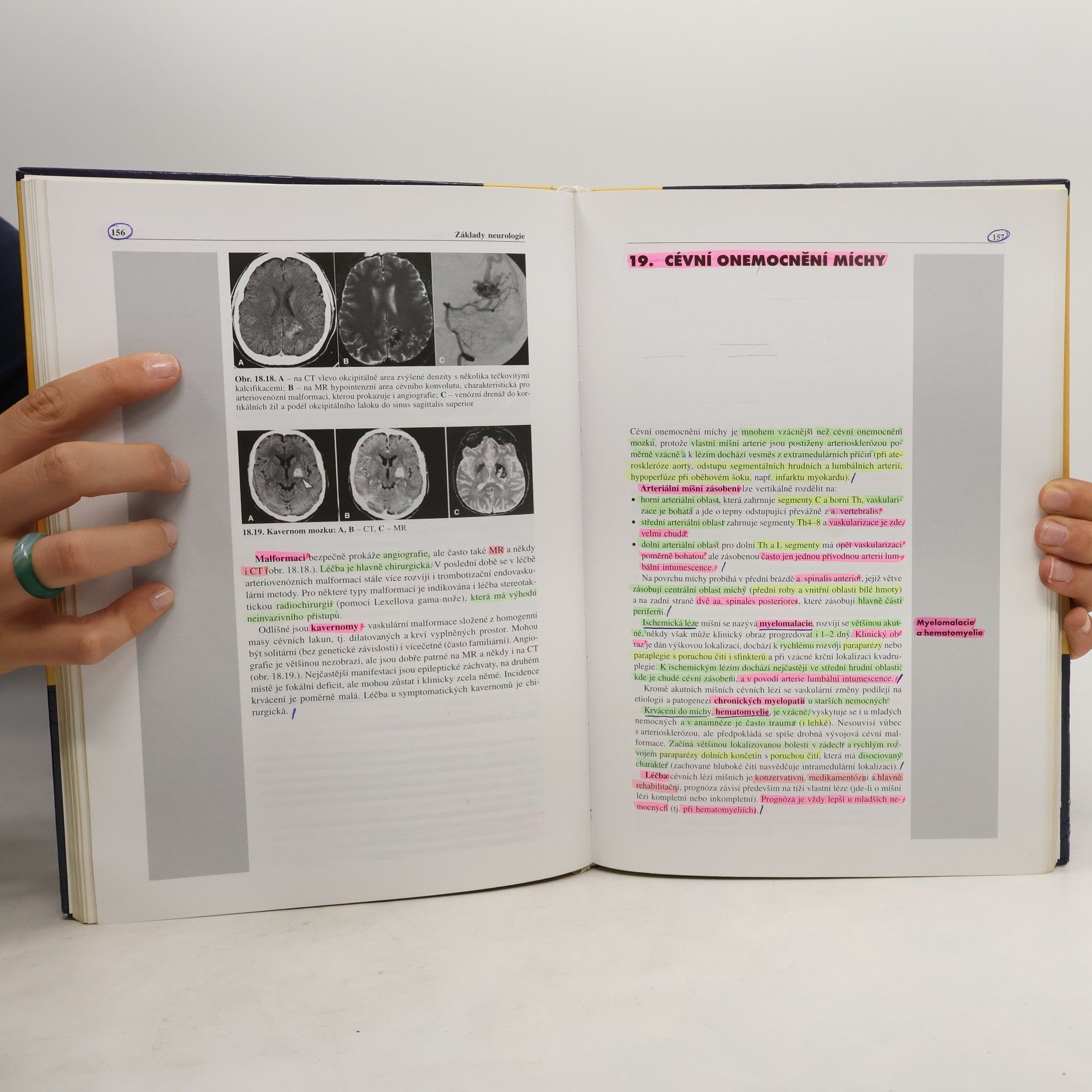 Zdeněk Ambler Základy neurologie