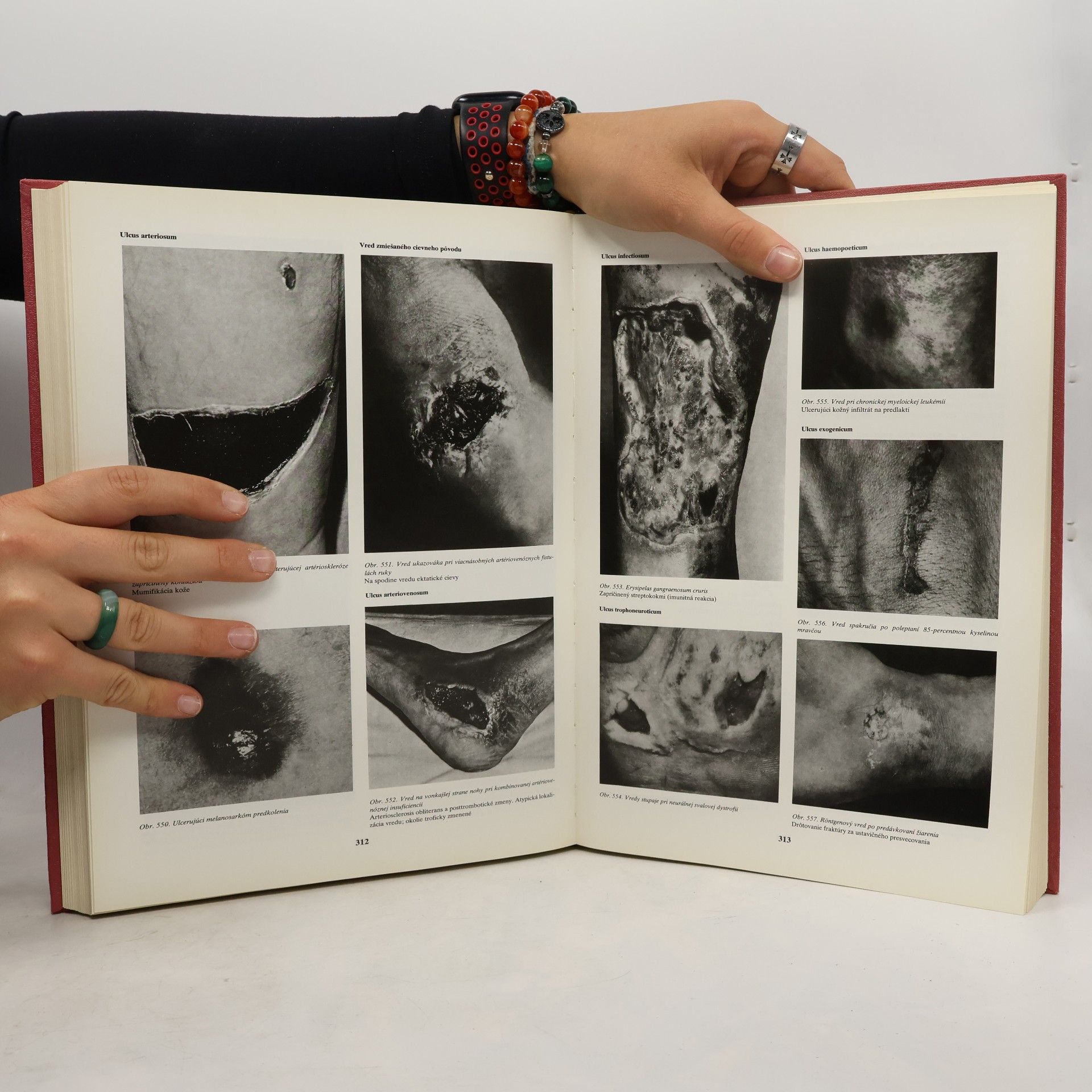 Arnold Kappert Angiológia učebnica a atlas