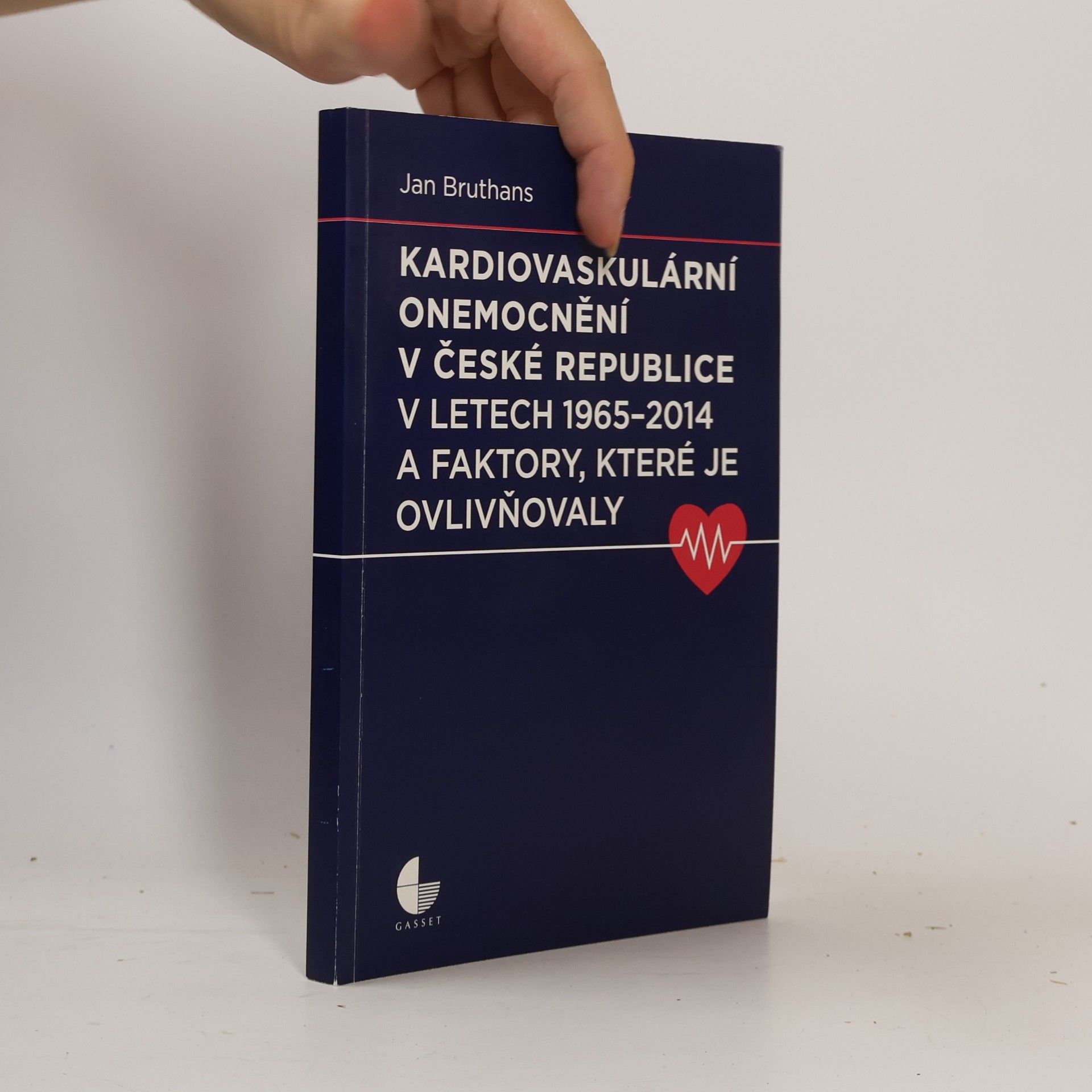 Kardiovaskulární onemocnění v České republice v letech 1965 - 2014 a faktory, které je ovlivňovaly