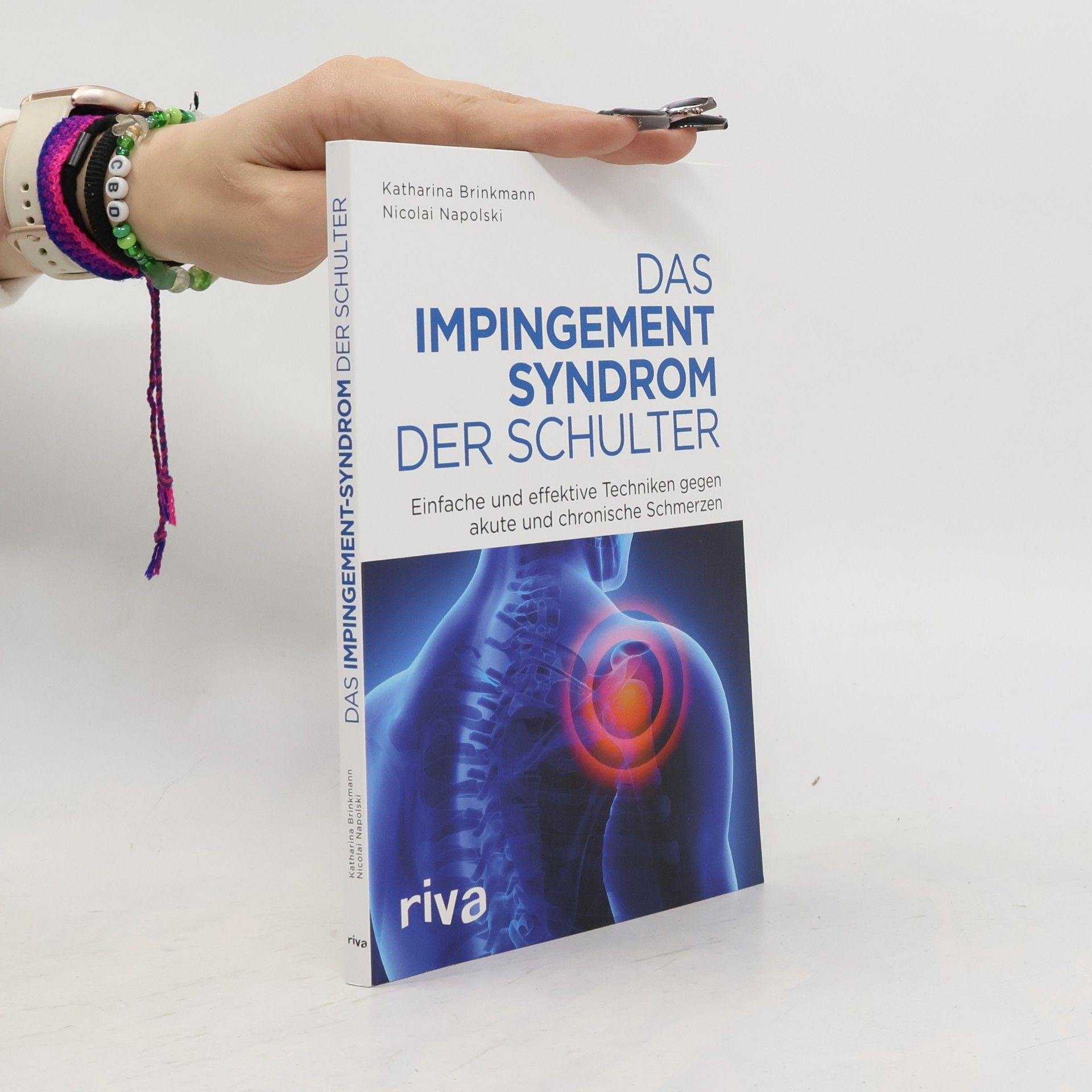 Das Impingement-Syndrom der Schulter