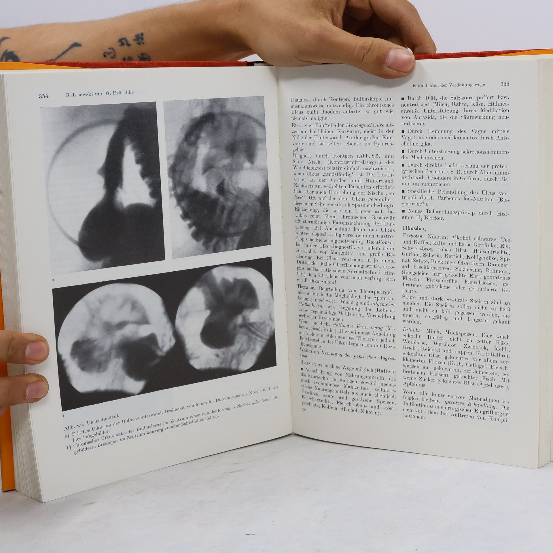 kolektiv Lehr buch der Inneren Medizin III