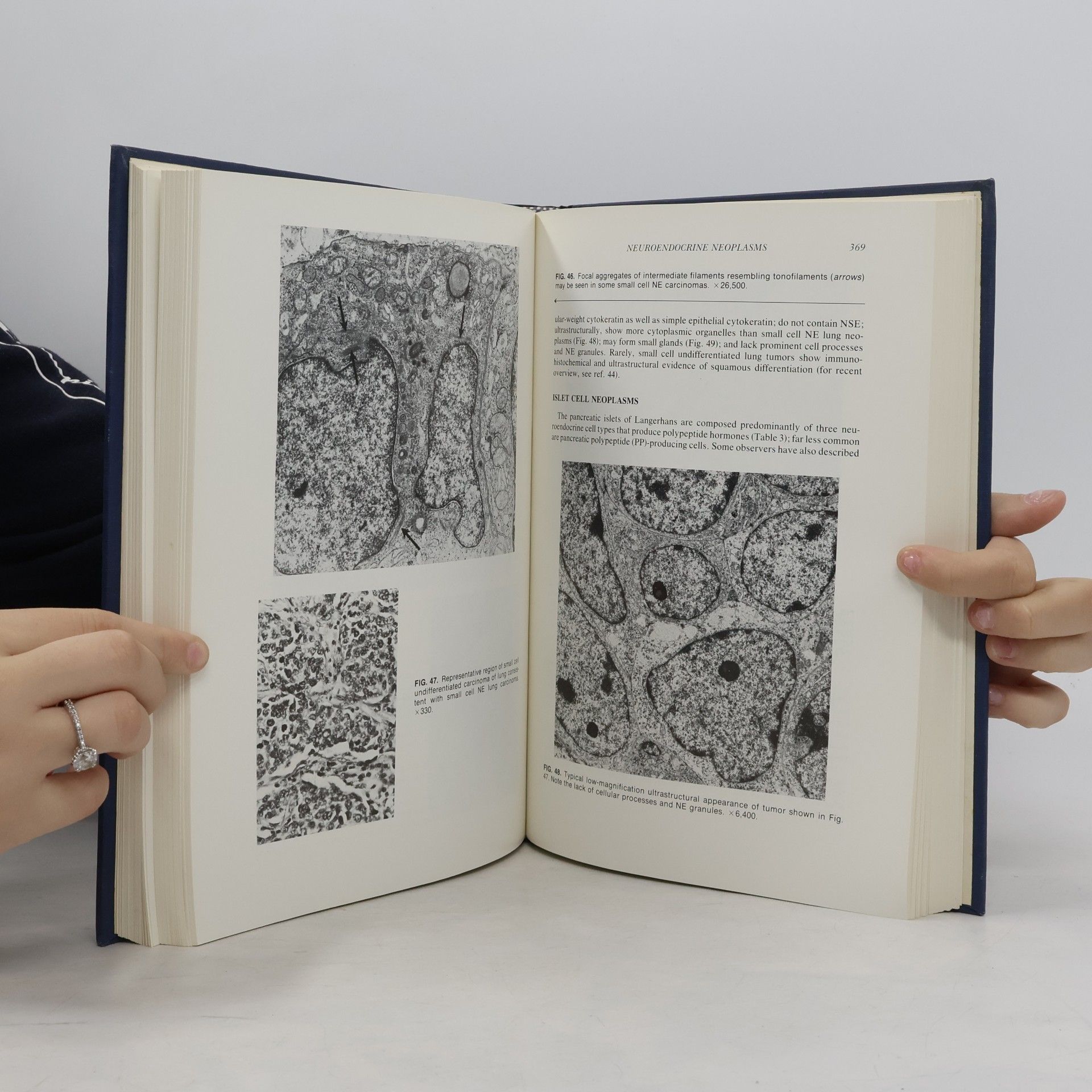 Henry A. Azar Pathology of Human Neoplasms