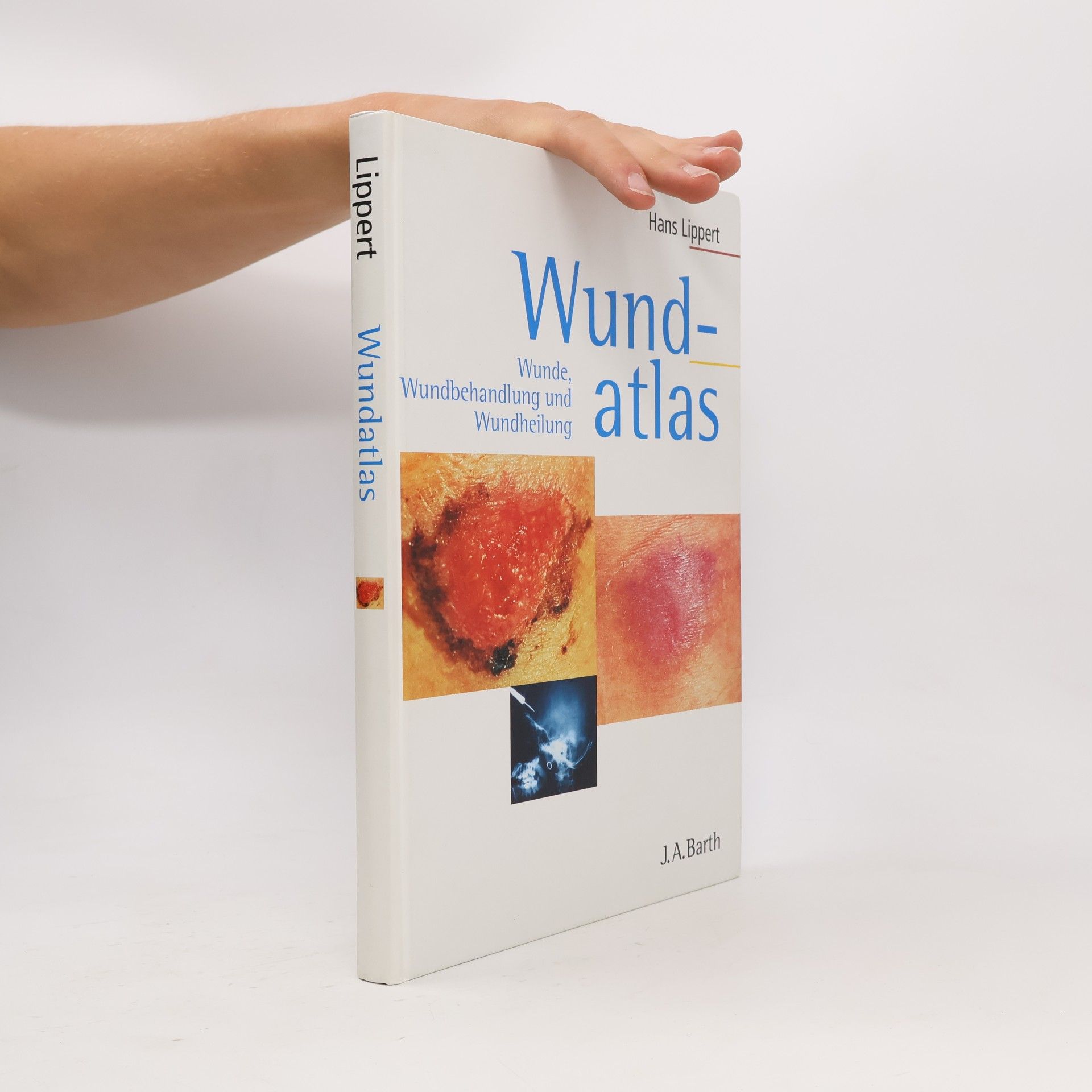 Hans Lippert Wundatlas
