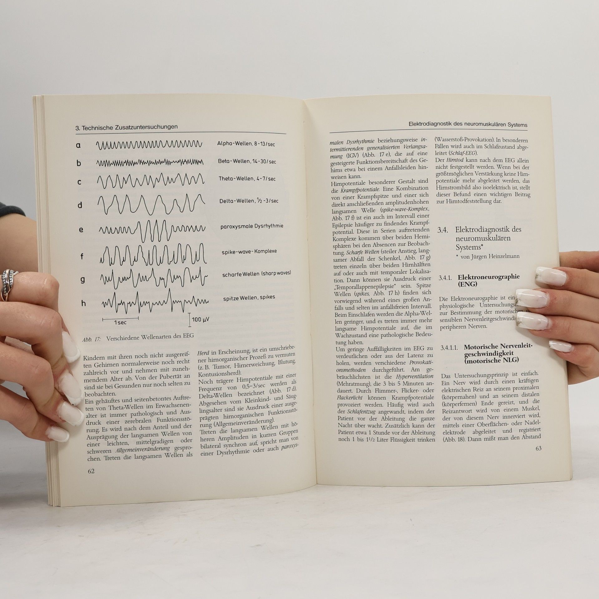 Horst Isermann Neurologie und neurologische Krankenpflege