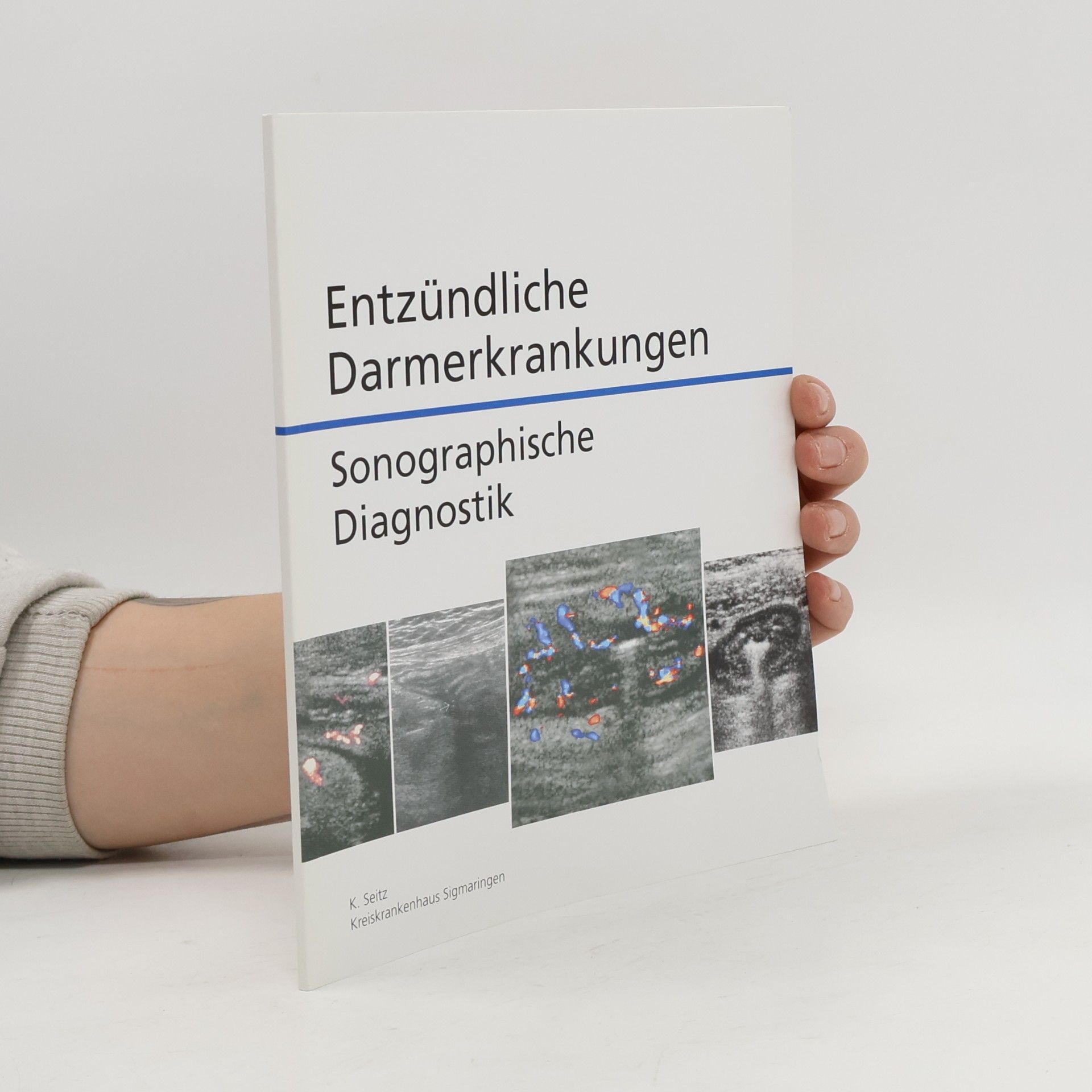 Autorenkollektiv Entzündliche Darmerkrankungen: Sonographische Diagnostik