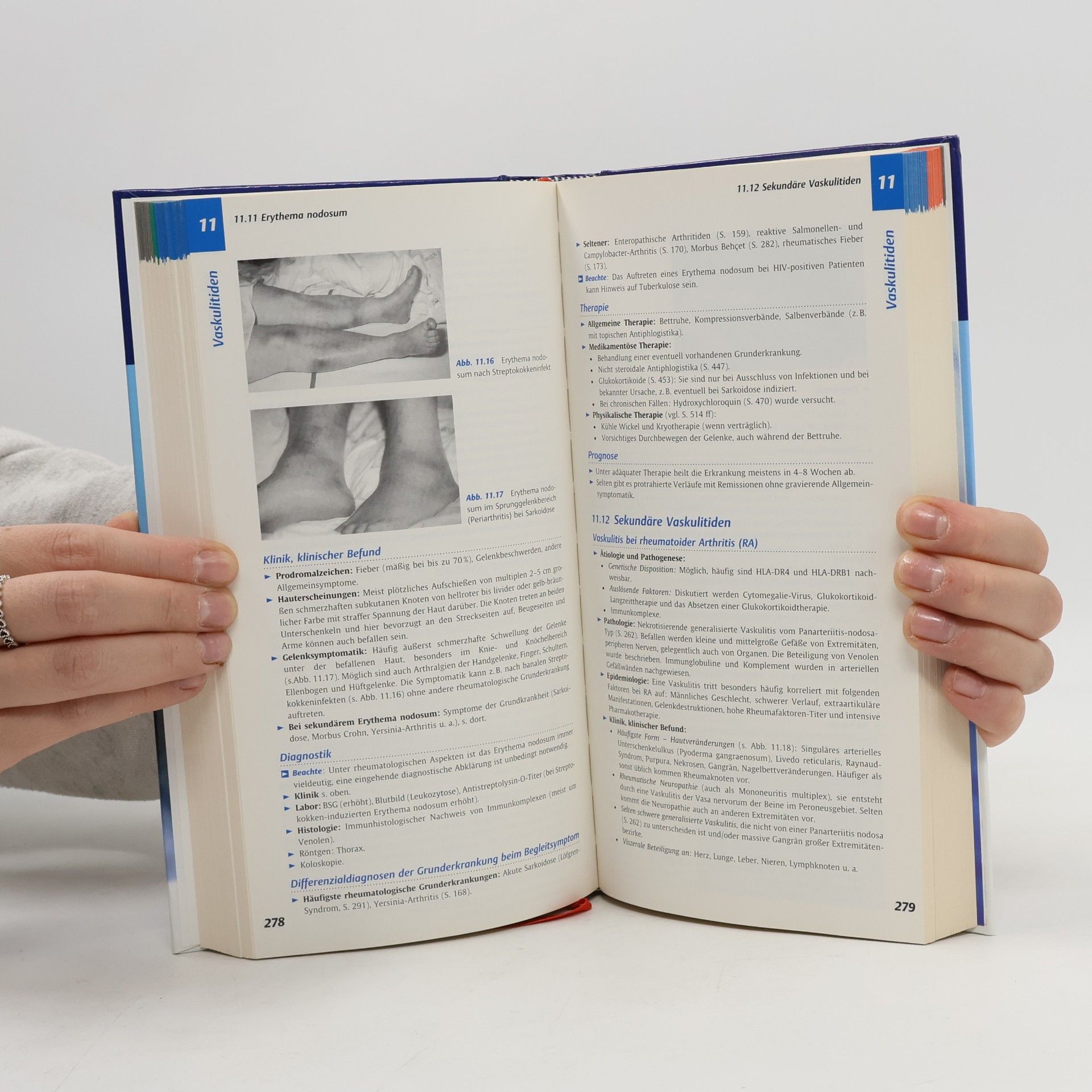 Bernhard Manger Checkliste XXL Rheumatologie