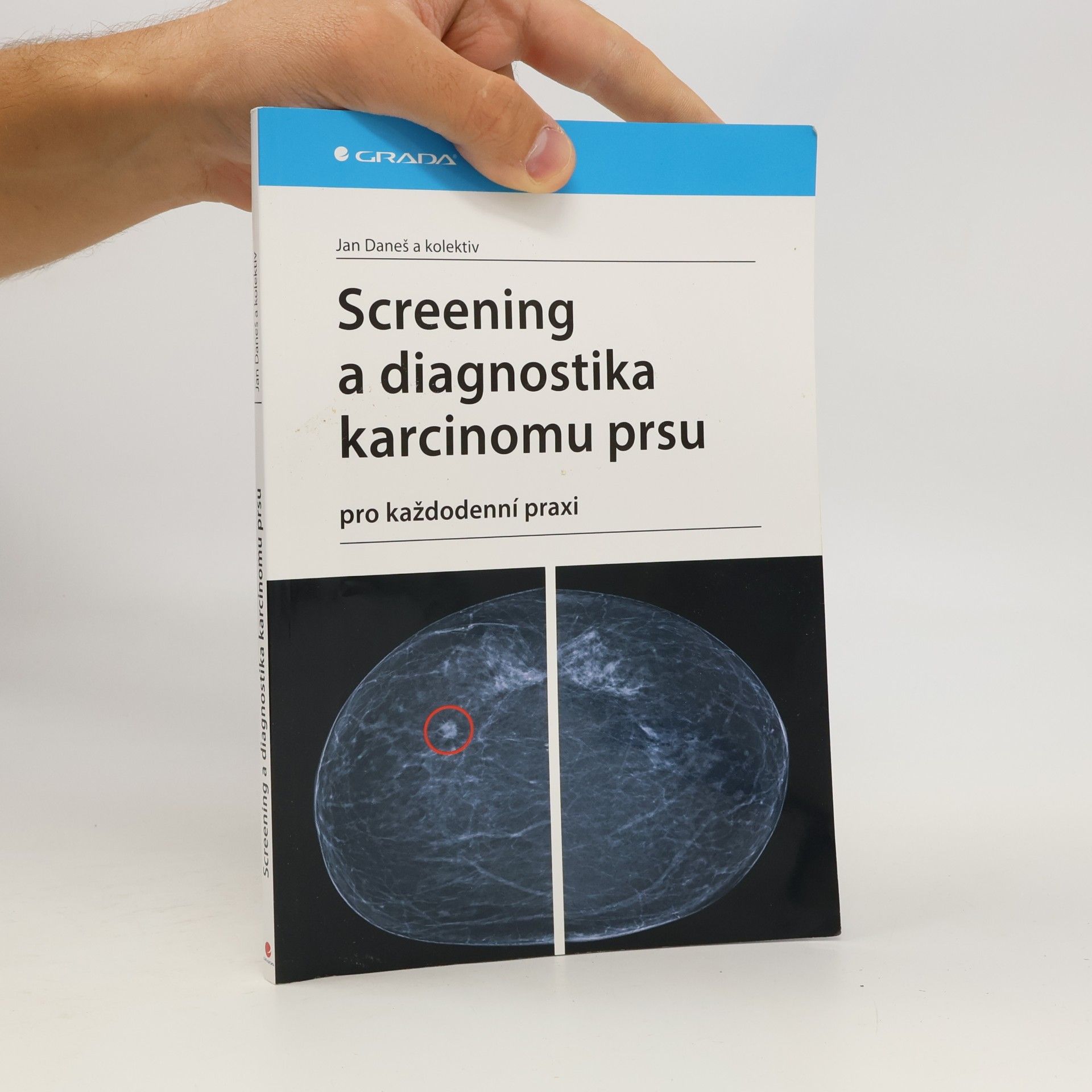 Jan Daneš Screening a diagnostika karcinomu prsu pro každodenní praxi